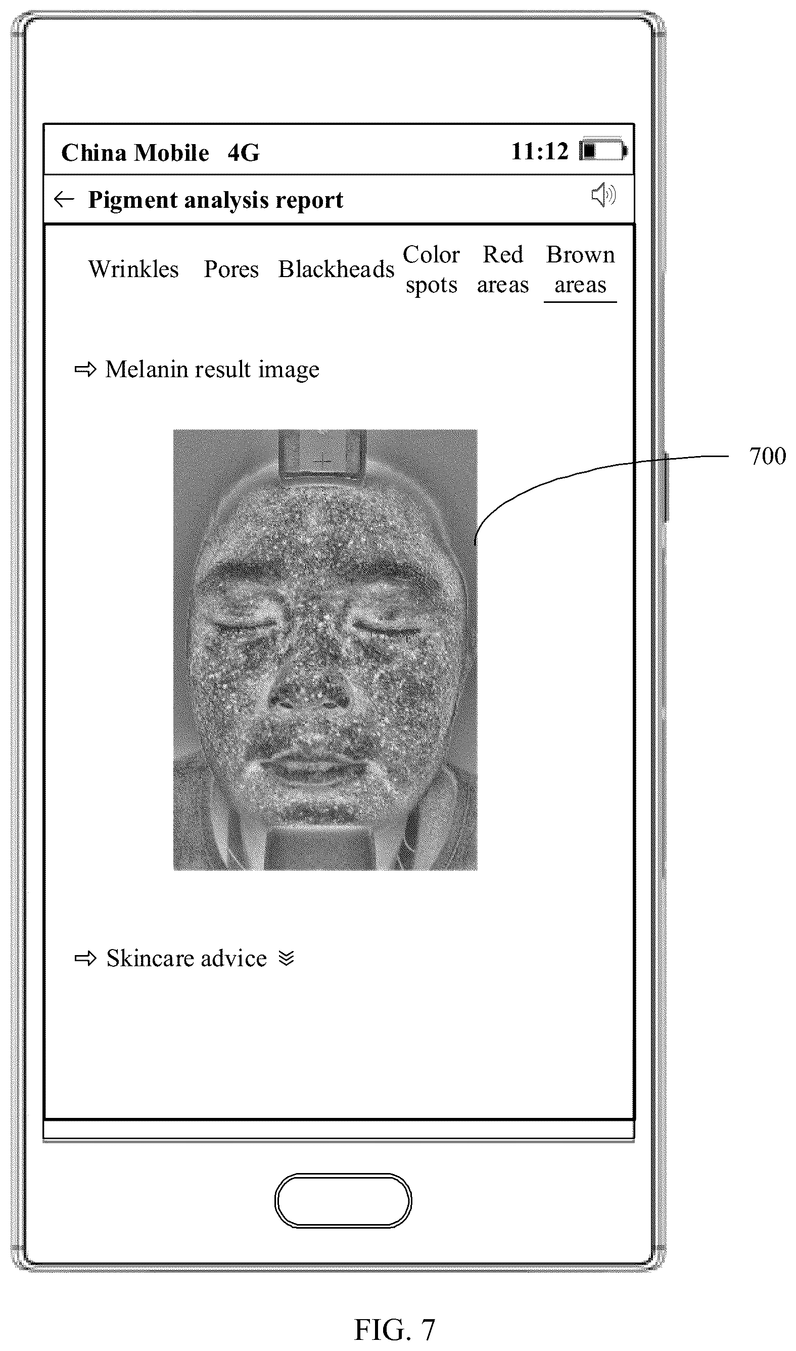Patent US11847798 Figure 11 – Pigment detection method and electronic device