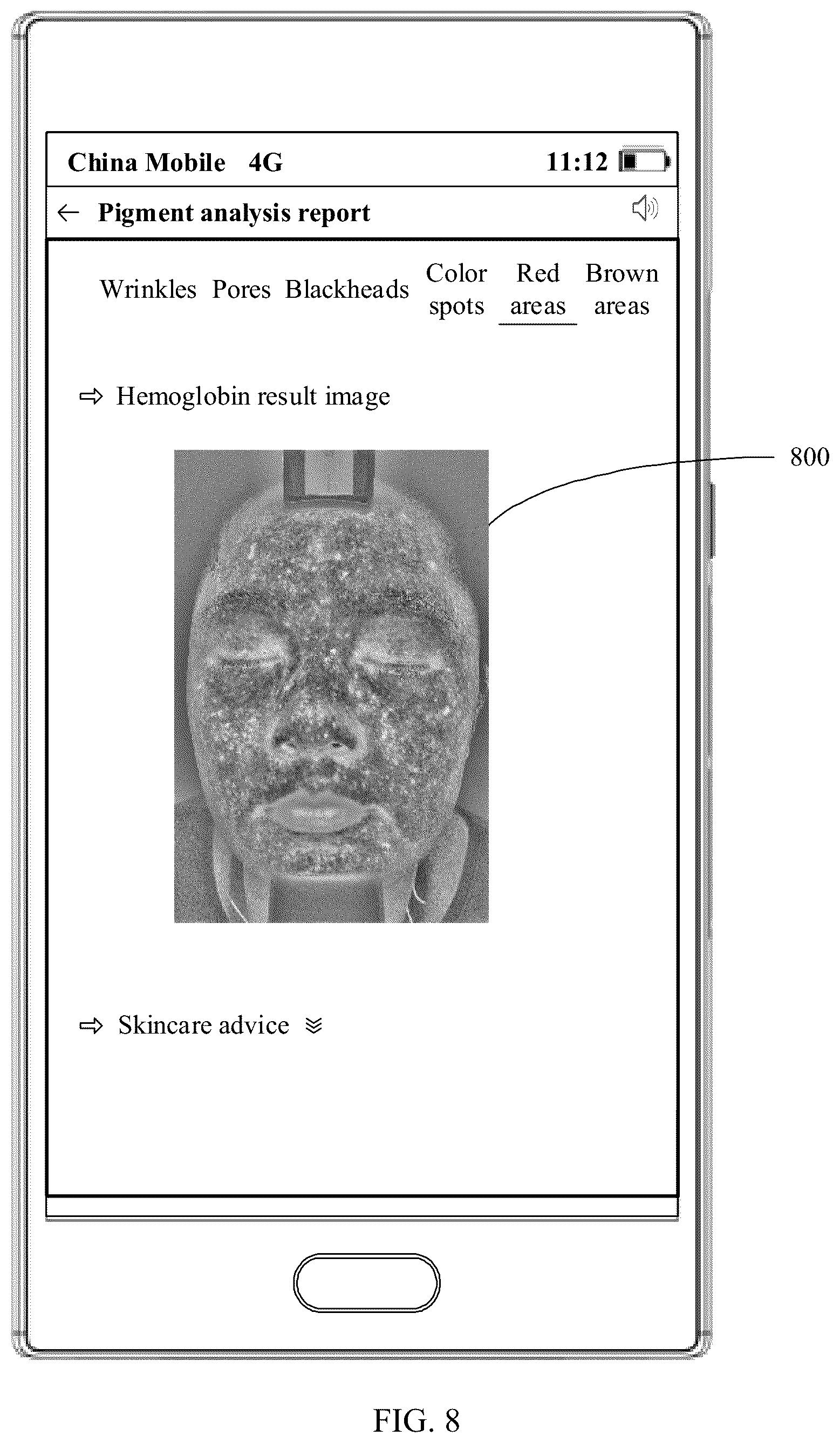 Patent US11847798 Figure 12 – Pigment detection method and electronic device