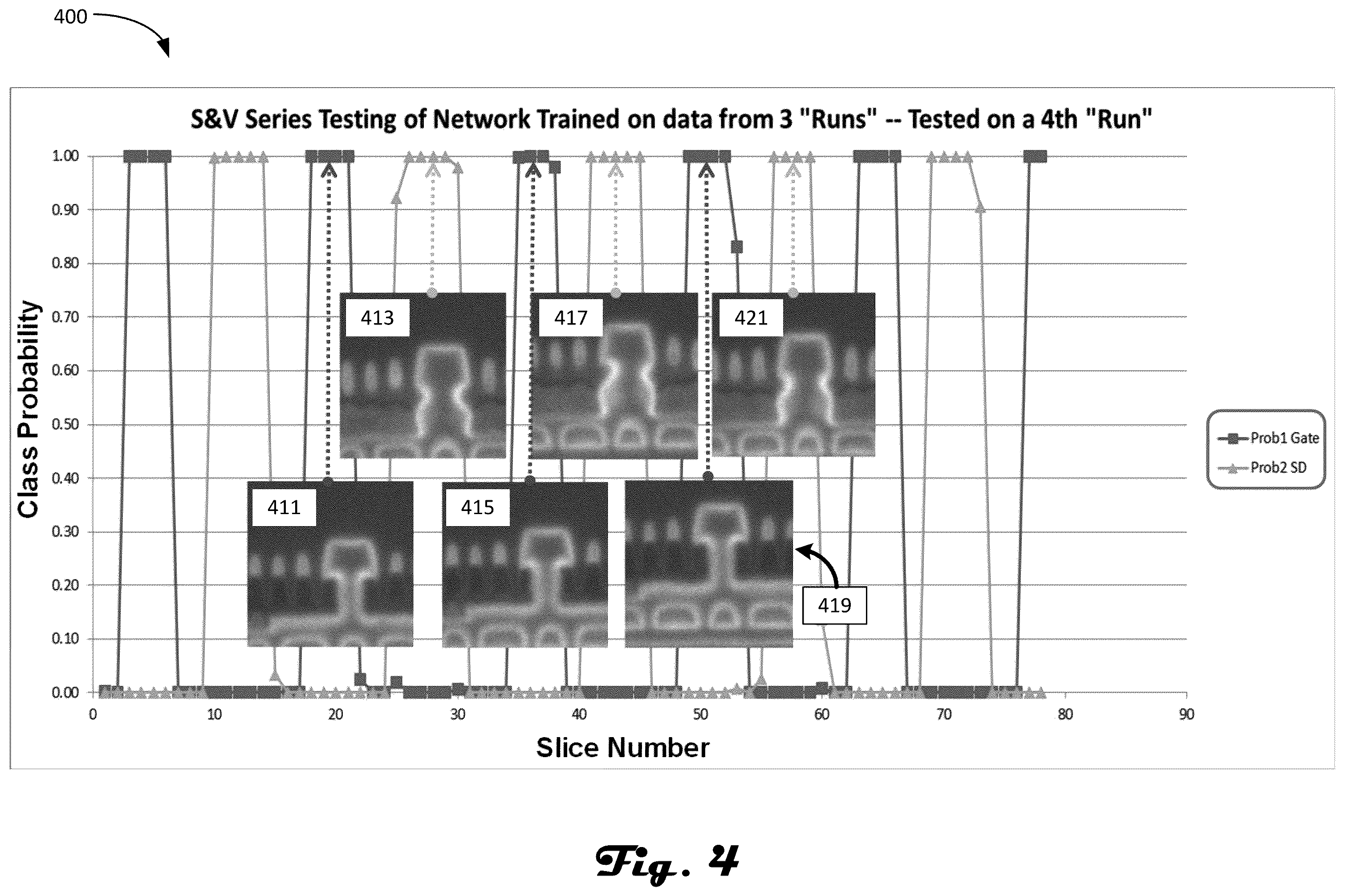Patent US11847813 Figure 4 – Artificial intelligence-enabled preparation end-pointing