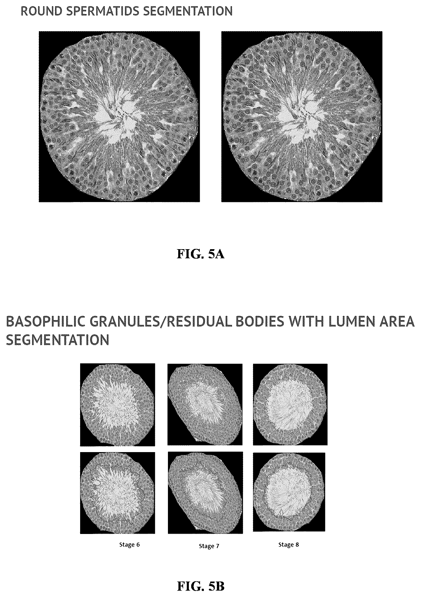 Patent US11847817 Figure 8 – Methods and systems for automated assessment of spermatogenesis
