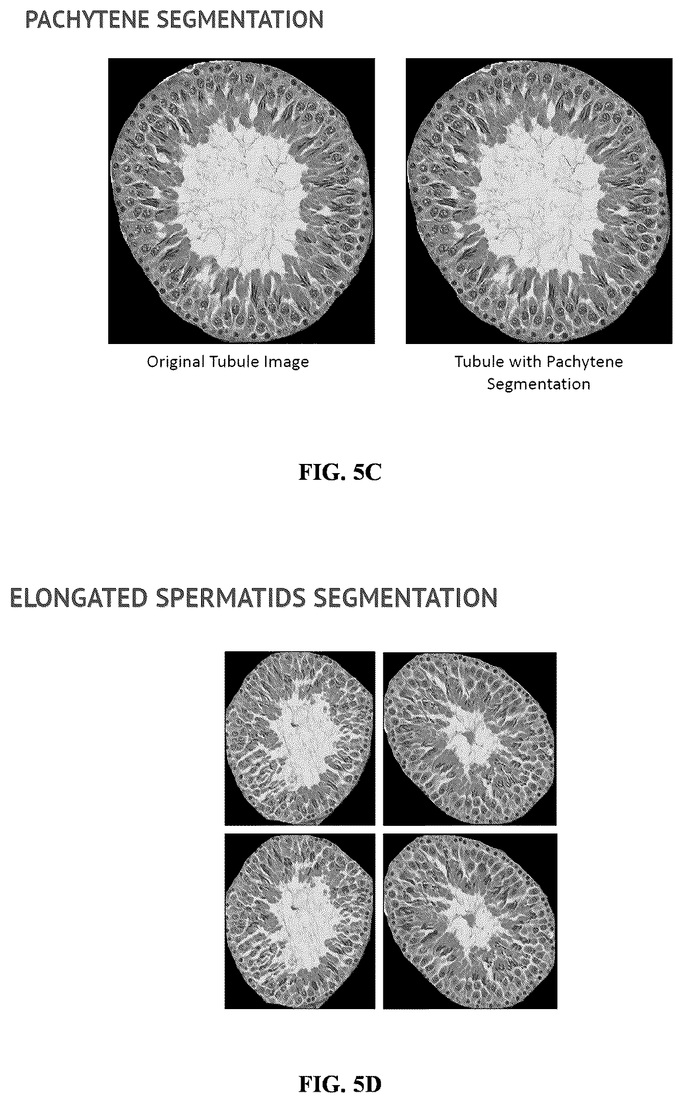 Patent US11847817 Figure 9 – Methods and systems for automated assessment of spermatogenesis