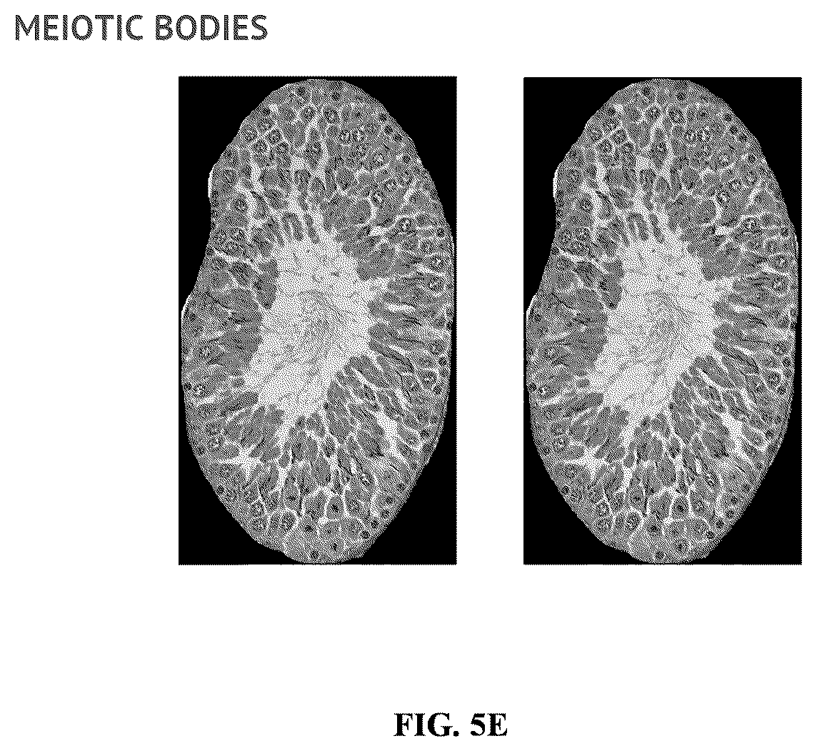 Patent US11847817 Figure 10 – Methods and systems for automated assessment of spermatogenesis