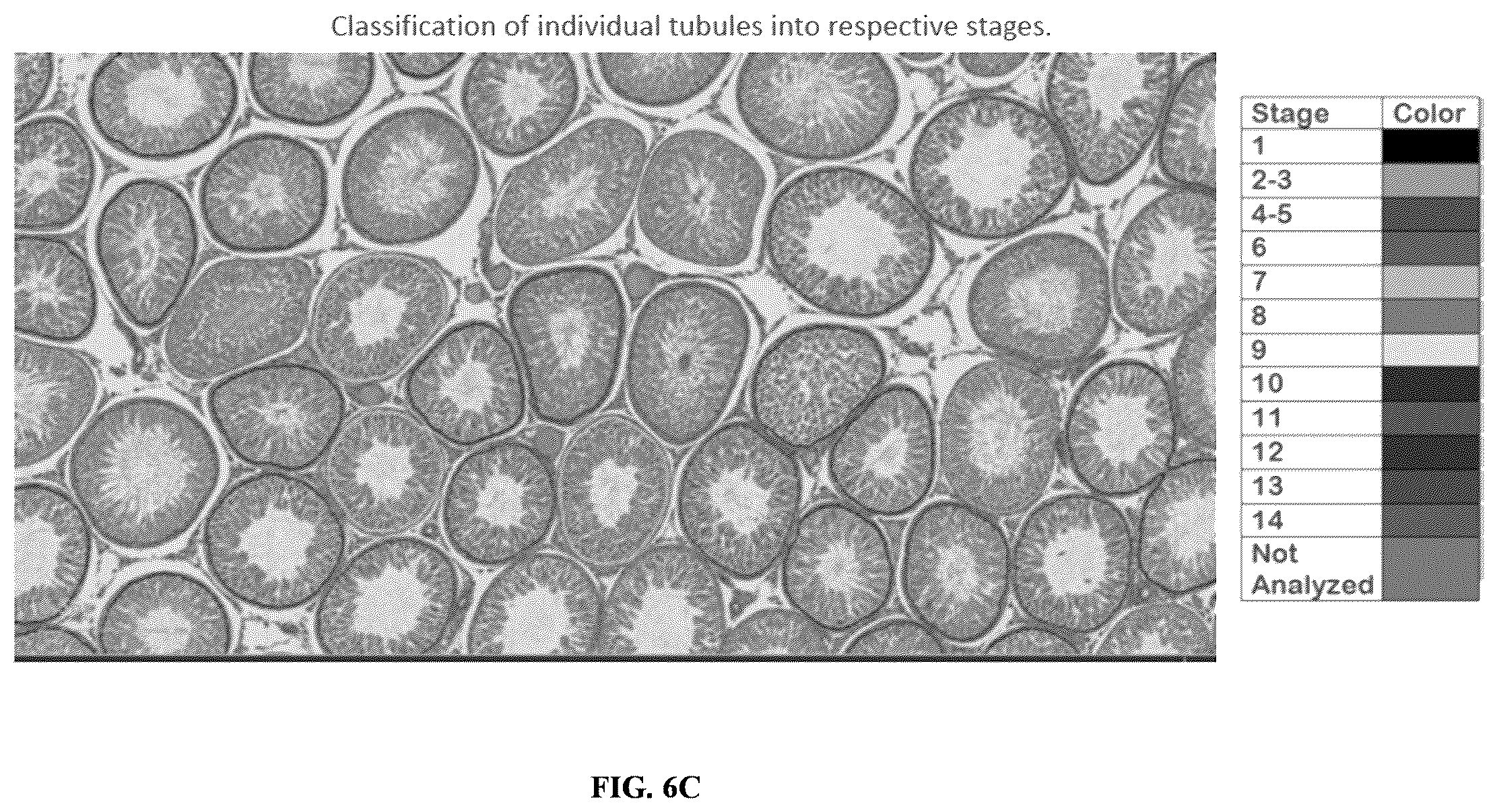 Patent US11847817 Figure 13 – Methods and systems for automated assessment of spermatogenesis