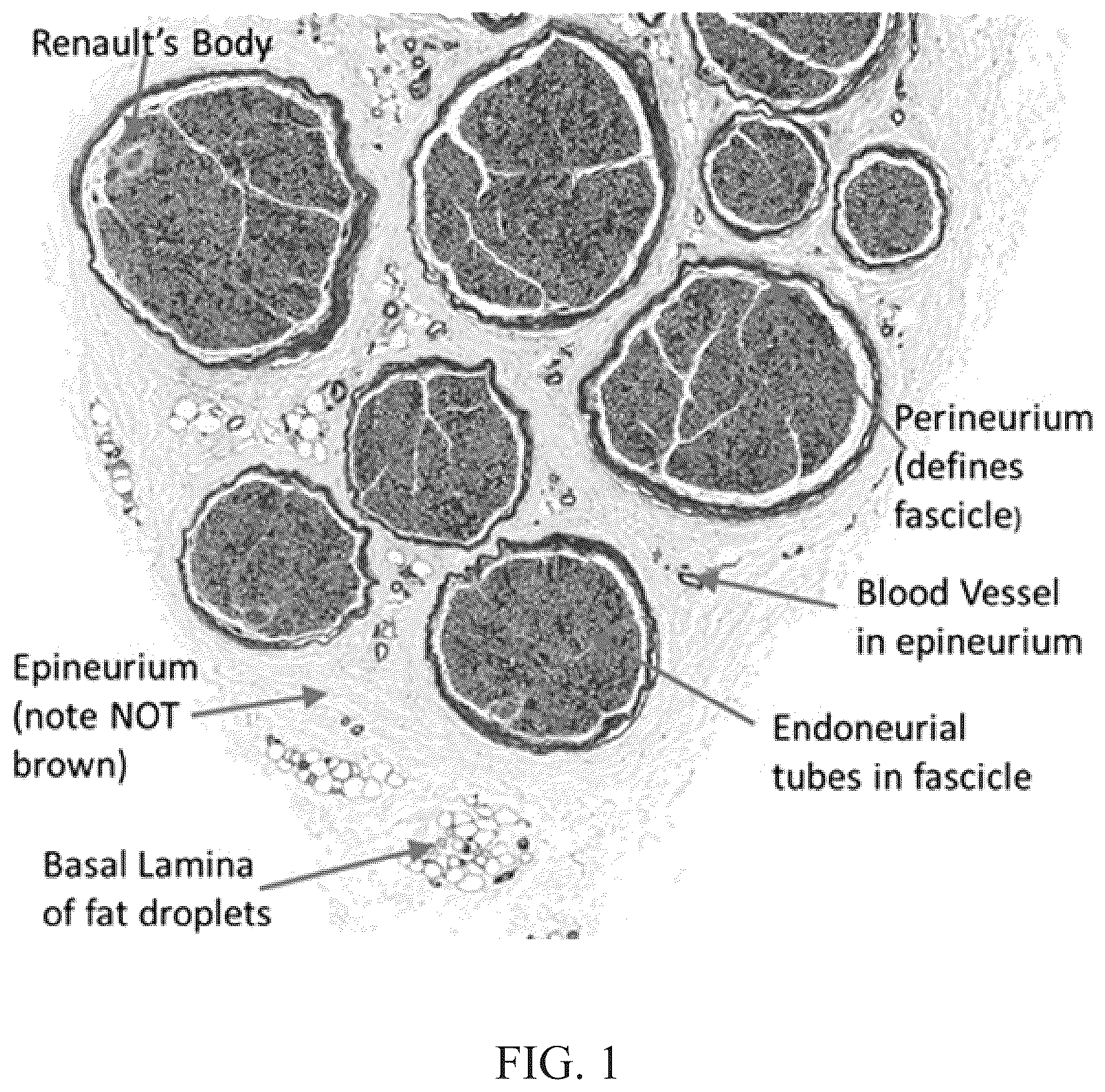 Patent US11847844 Figure 1 – Quantitative structural assay of a nerve graft
