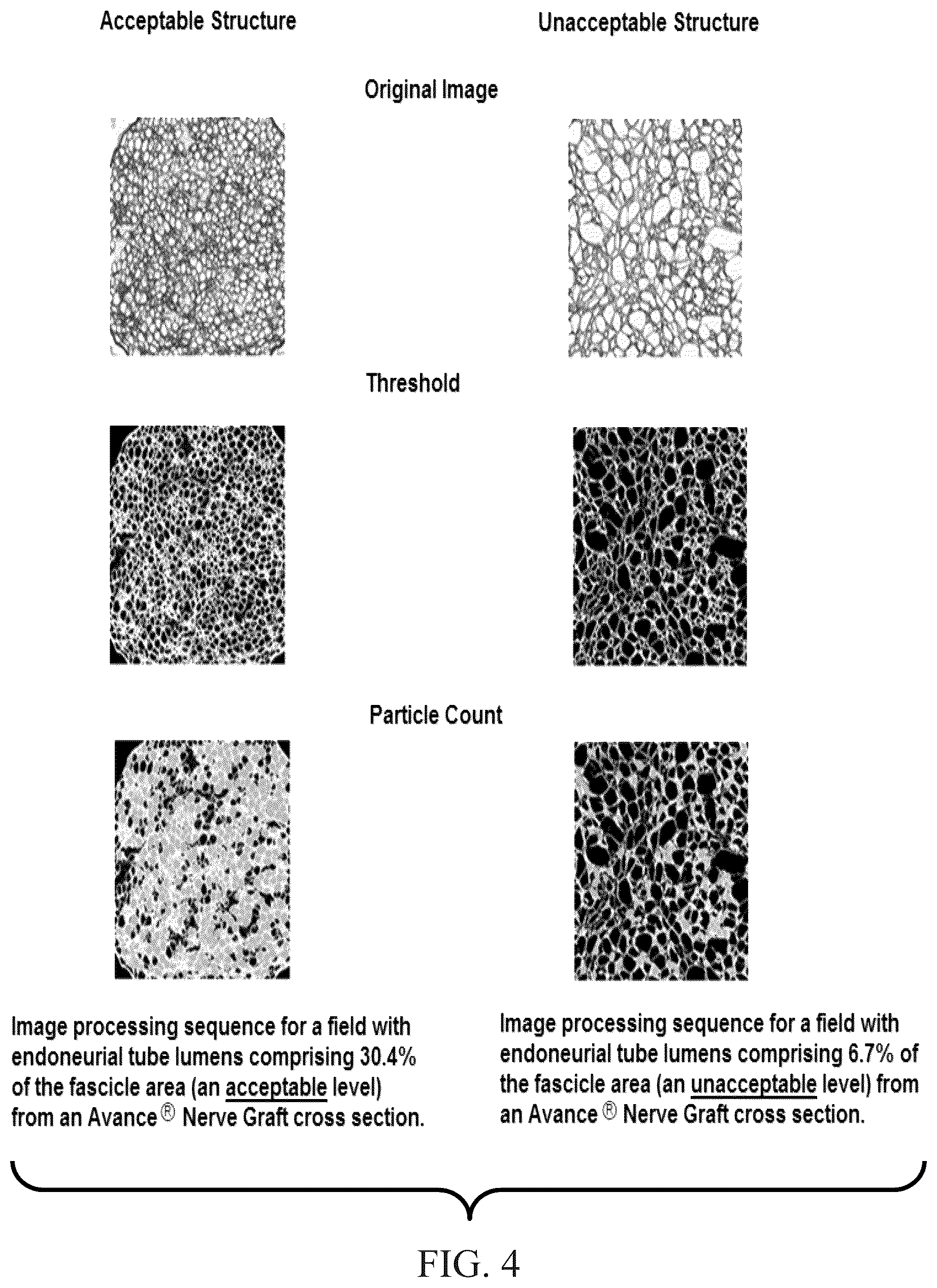 Patent US11847844 Figure 4 – Quantitative structural assay of a nerve graft