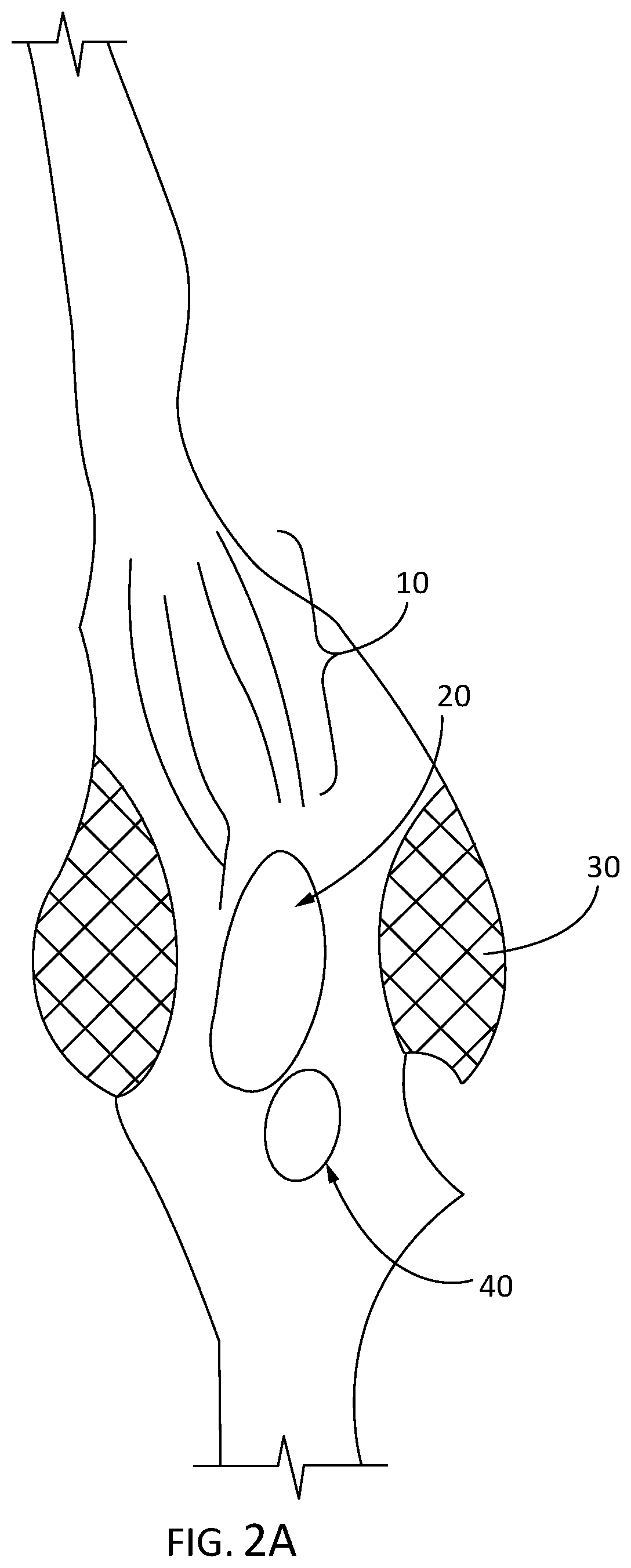 Patent US11847932 Figure 2 – Modified animal organs for use in surgical simulators