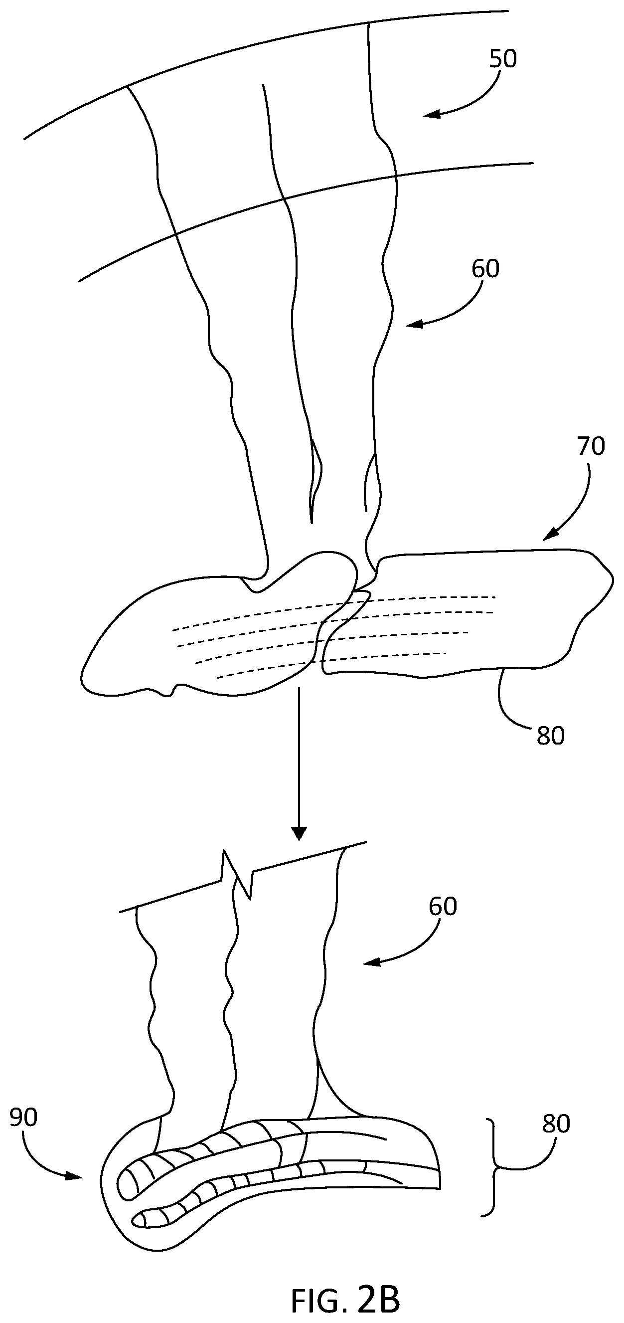 Patent US11847932 Figure 3 – Modified animal organs for use in surgical simulators