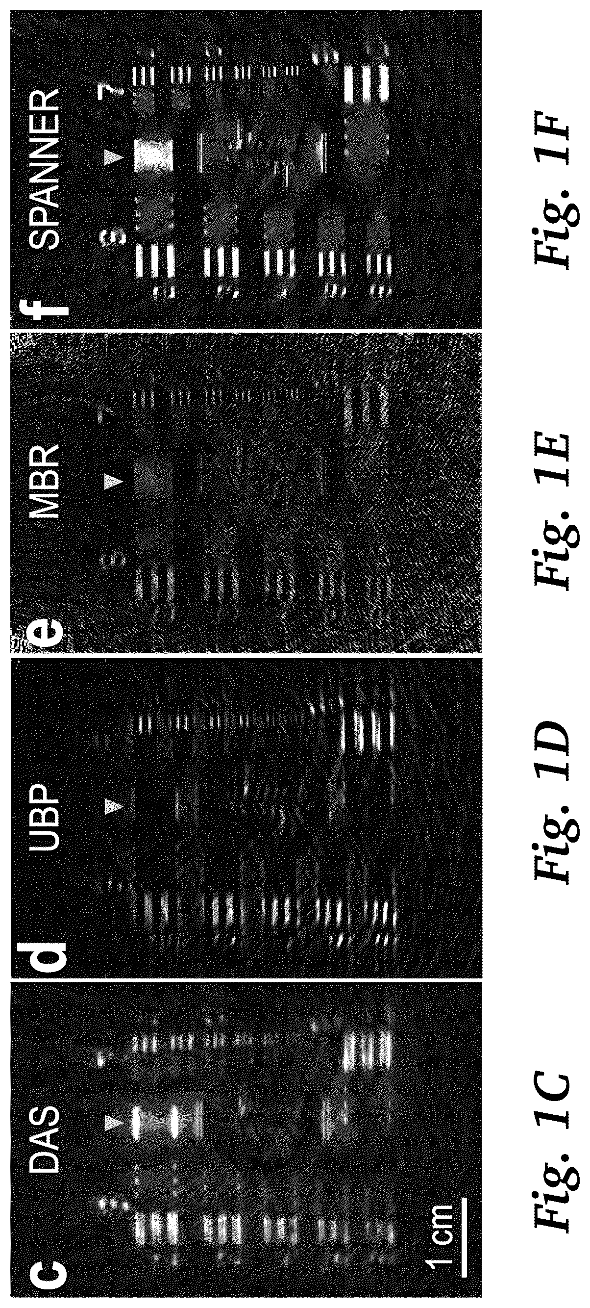 Patent US11854124 Figure 3 – Real-time photoacoustic imaging using a precise forward model and fast iterative inverse
