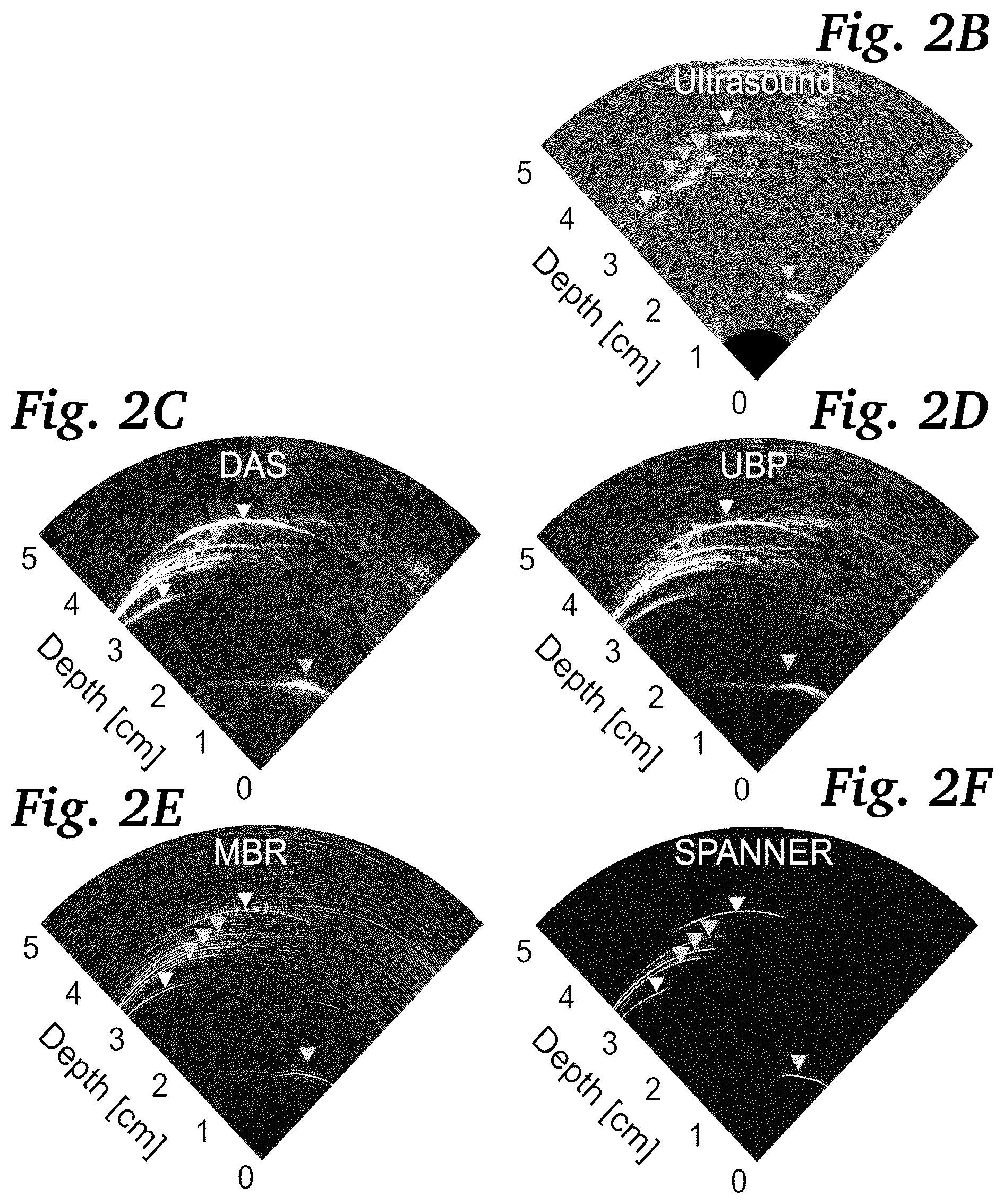 Patent US11854124 Figure 5 – Real-time photoacoustic imaging using a precise forward model and fast iterative inverse
