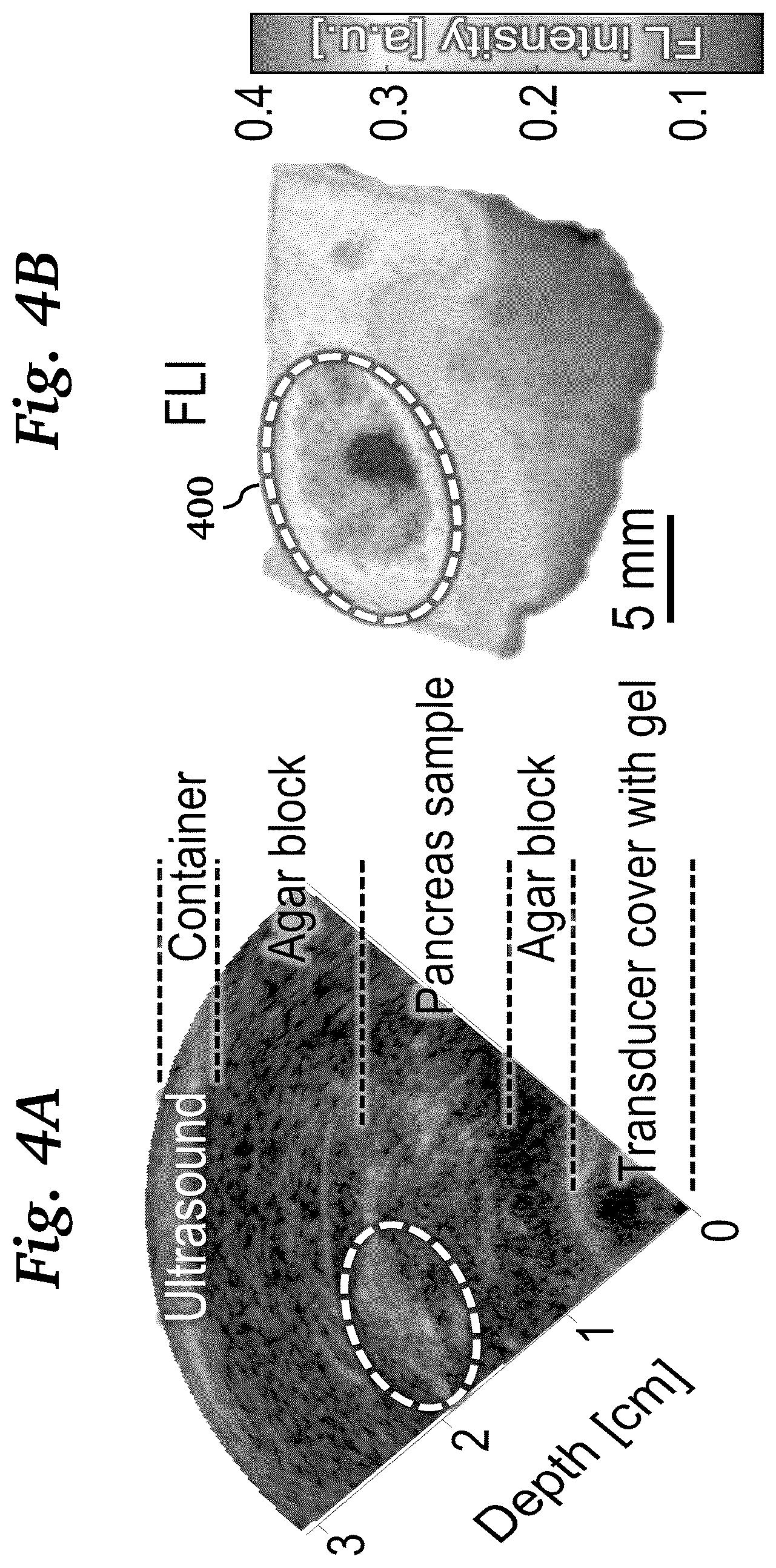Patent US11854124 Figure 9 – Real-time photoacoustic imaging using a precise forward model and fast iterative inverse