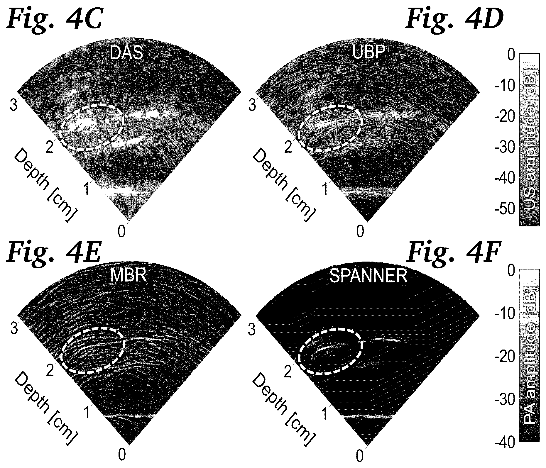 Patent US11854124 Figure 10 – Real-time photoacoustic imaging using a precise forward model and fast iterative inverse