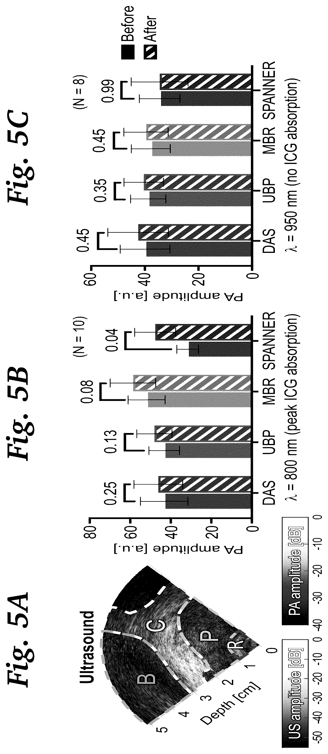 Patent US11854124 Figure 11 – Real-time photoacoustic imaging using a precise forward model and fast iterative inverse
