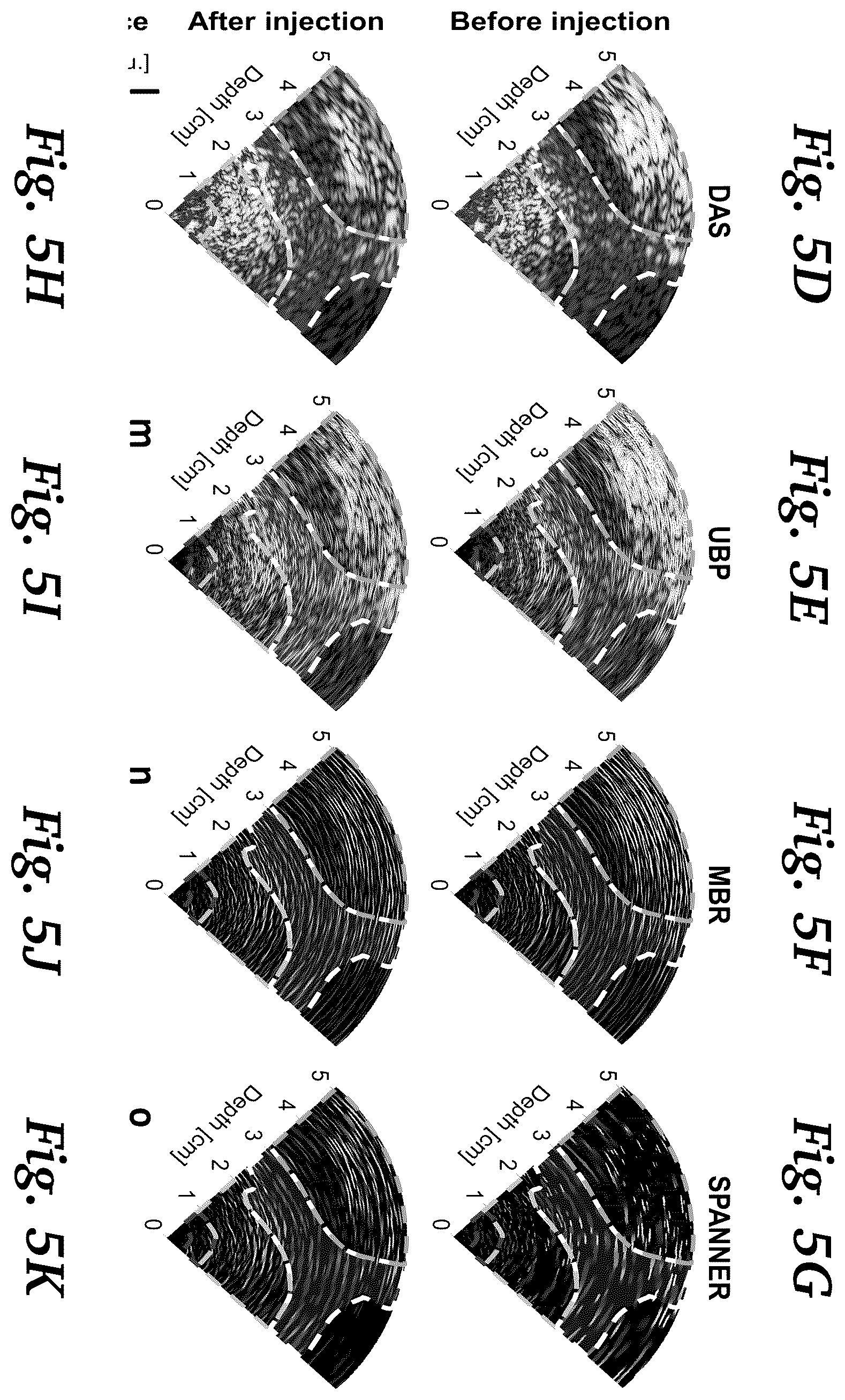 Patent US11854124 Figure 12 – Real-time photoacoustic imaging using a precise forward model and fast iterative inverse