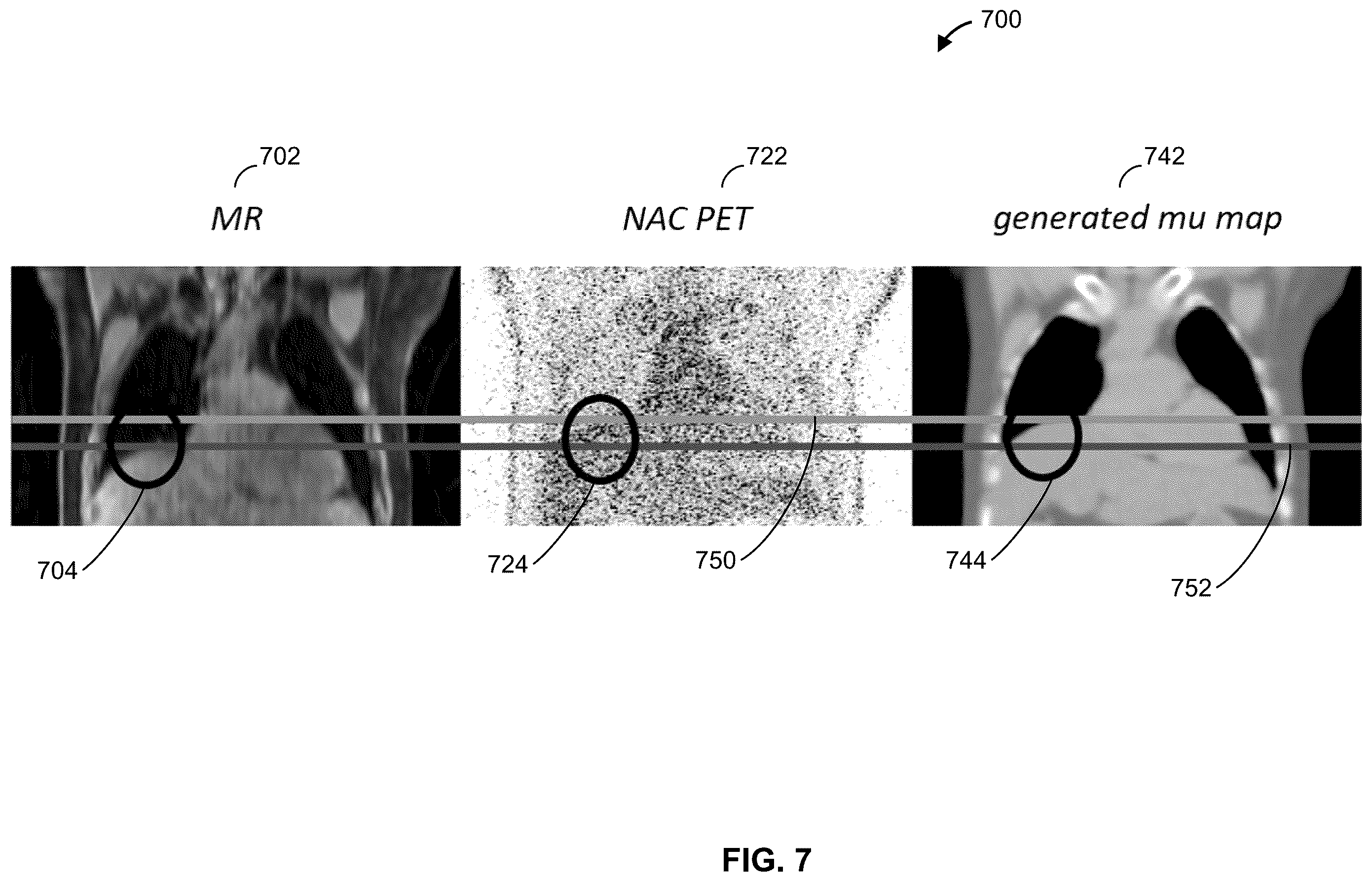 Patent US11854126 Figure 9 – Methods and apparatus for deep learning based image attenuation correction