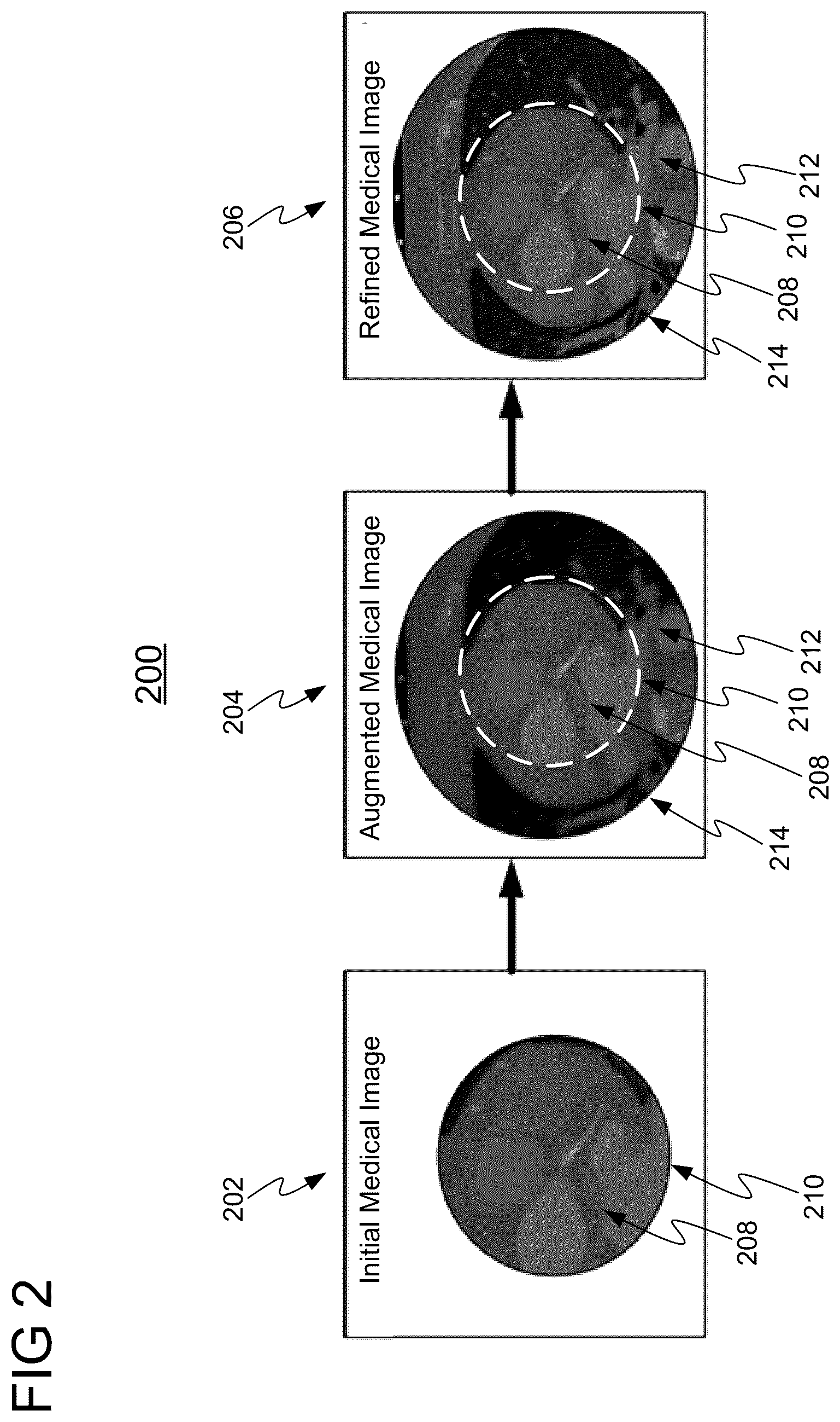 Patent US11854158 Figure 2 – Medical image enhancement