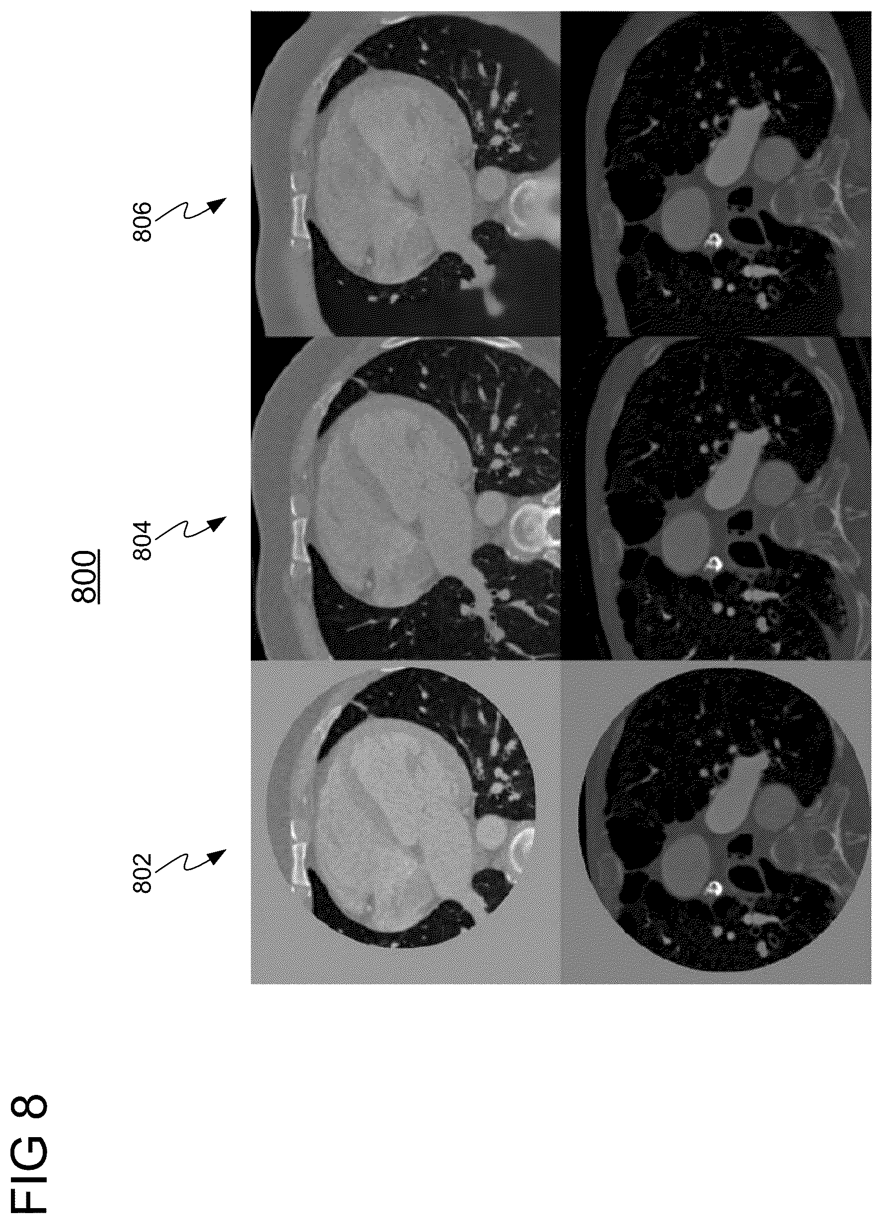 Patent US11854158 Figure 8 – Medical image enhancement