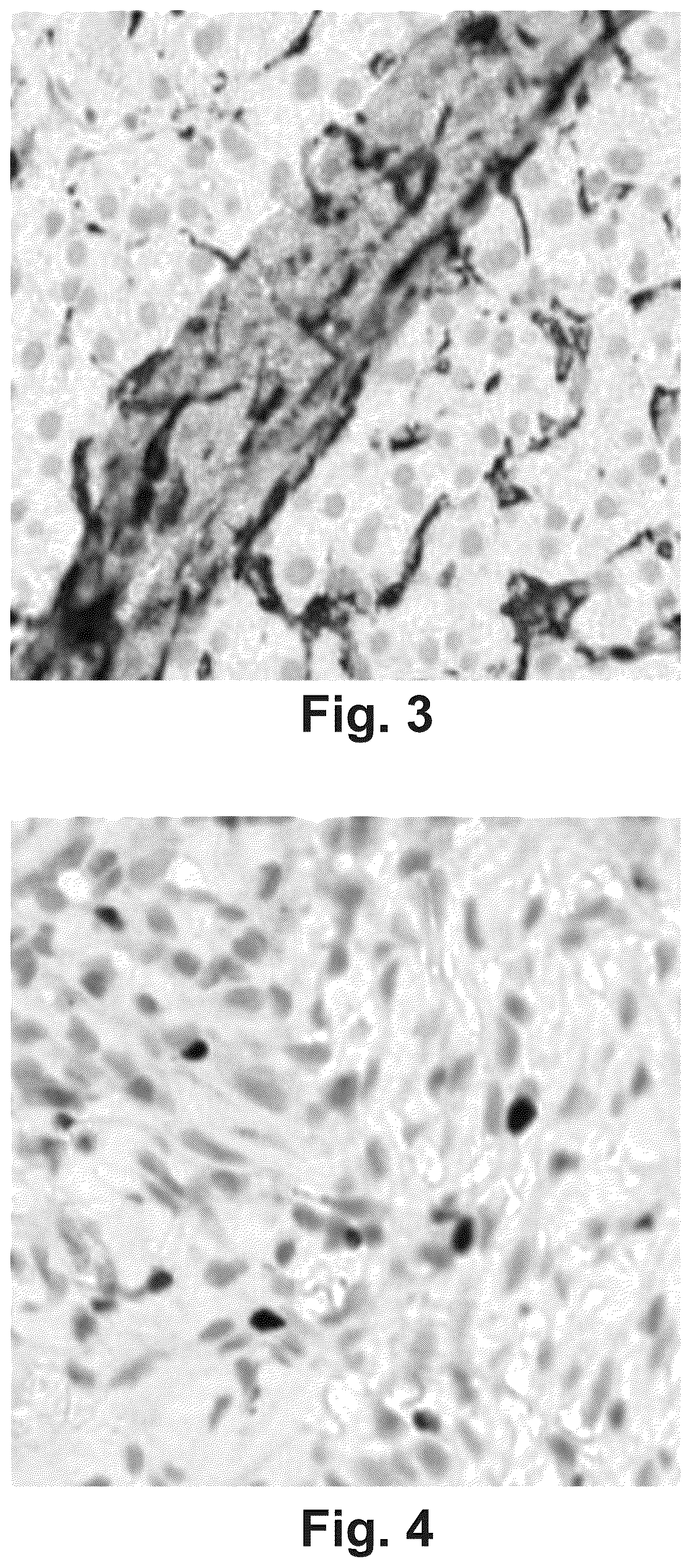 Patent US11854168 Figure 3 – Artifacts removal from tissue images