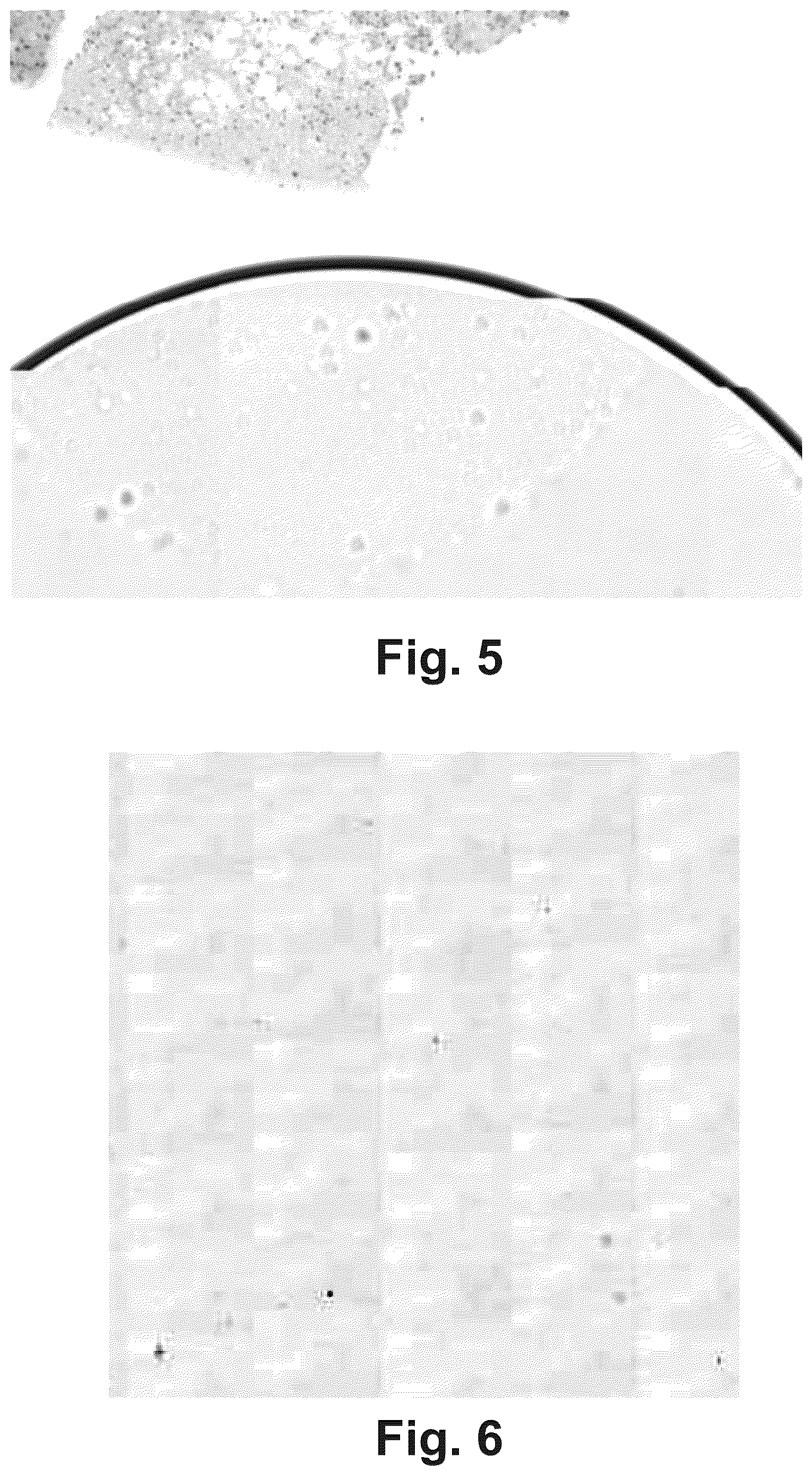 Patent US11854168 Figure 4 – Artifacts removal from tissue images