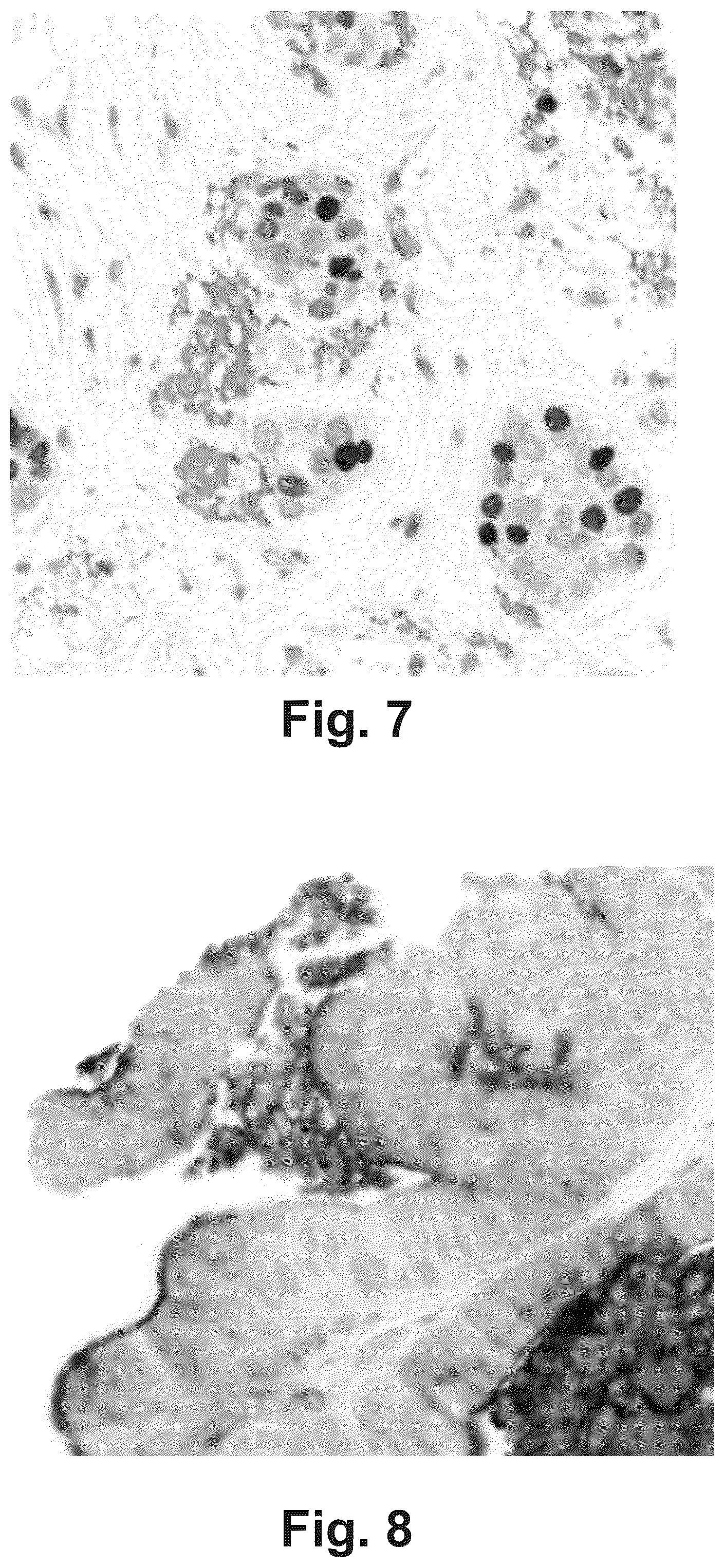 Patent US11854168 Figure 5 – Artifacts removal from tissue images