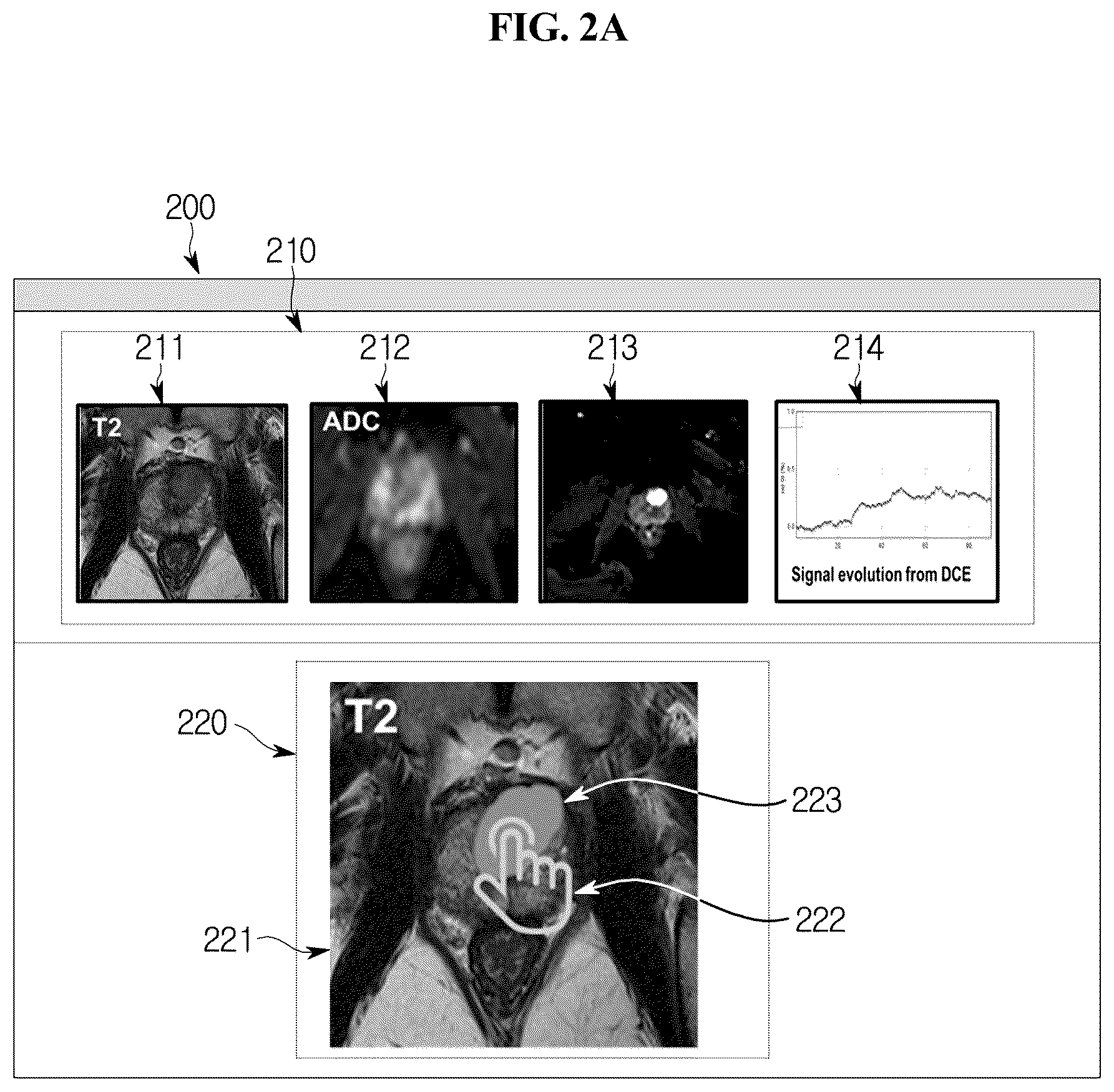 Patent US11854193 Figure 2 – Validity evaluation device for cancer region detection