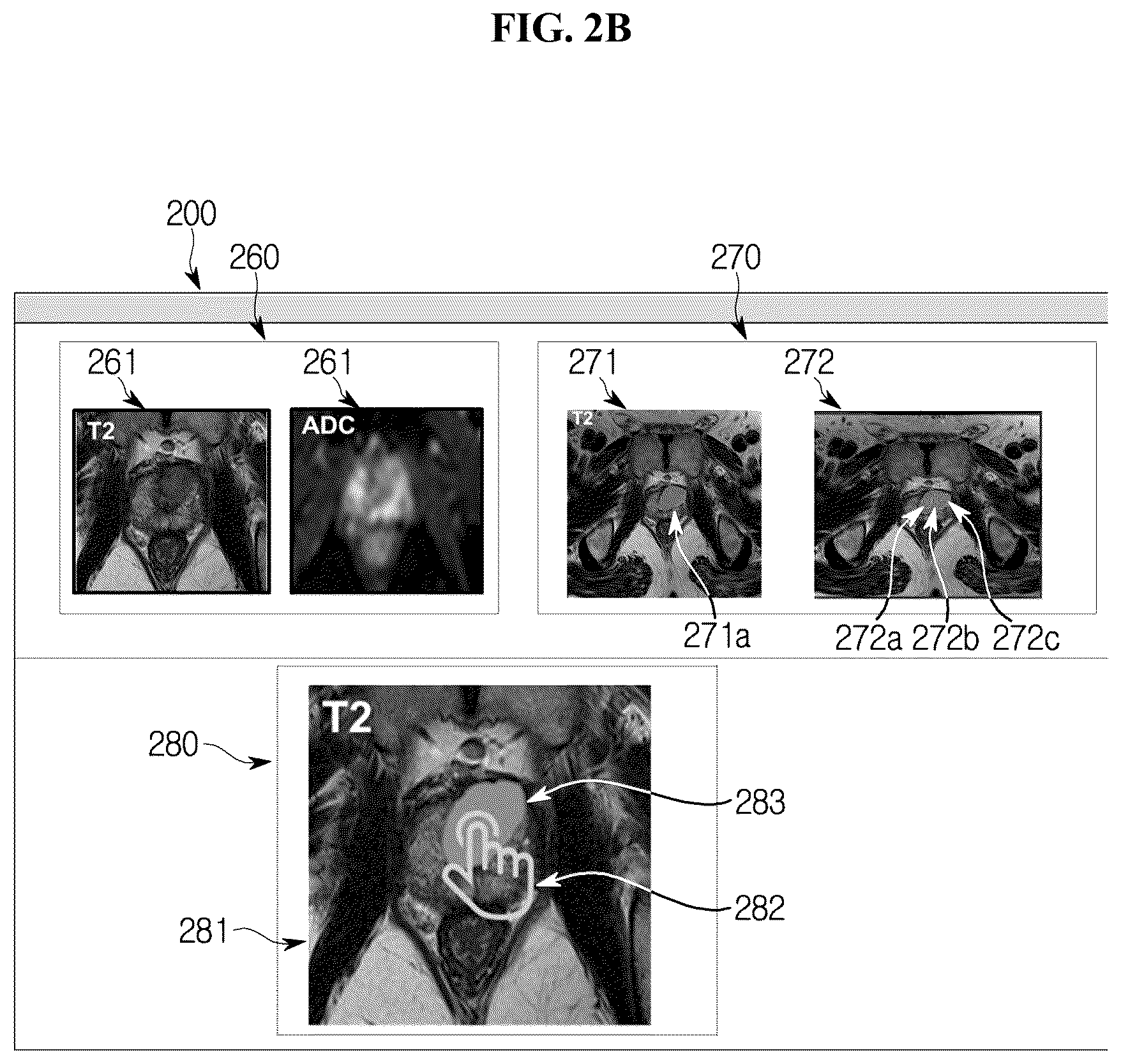 Patent US11854193 Figure 3 – Validity evaluation device for cancer region detection