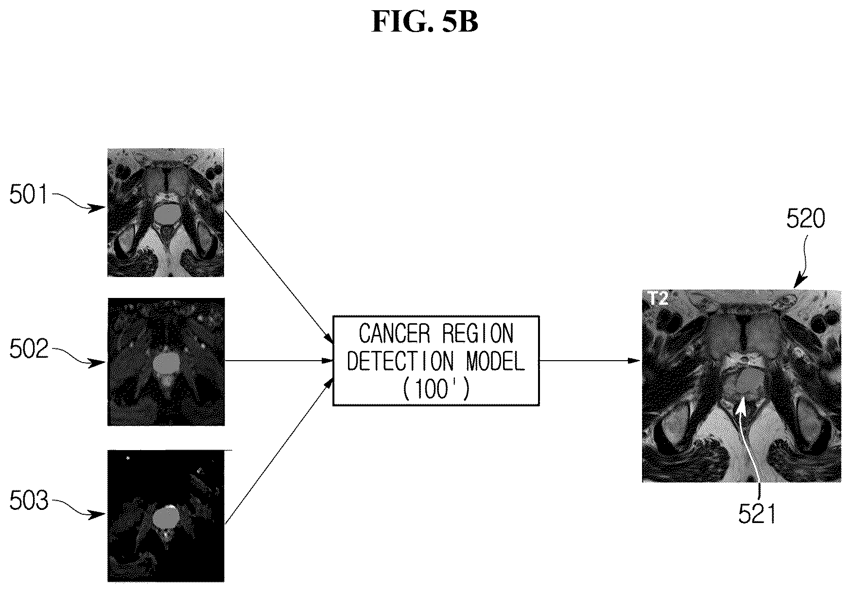 Patent US11854193 Figure 9 – Validity evaluation device for cancer region detection
