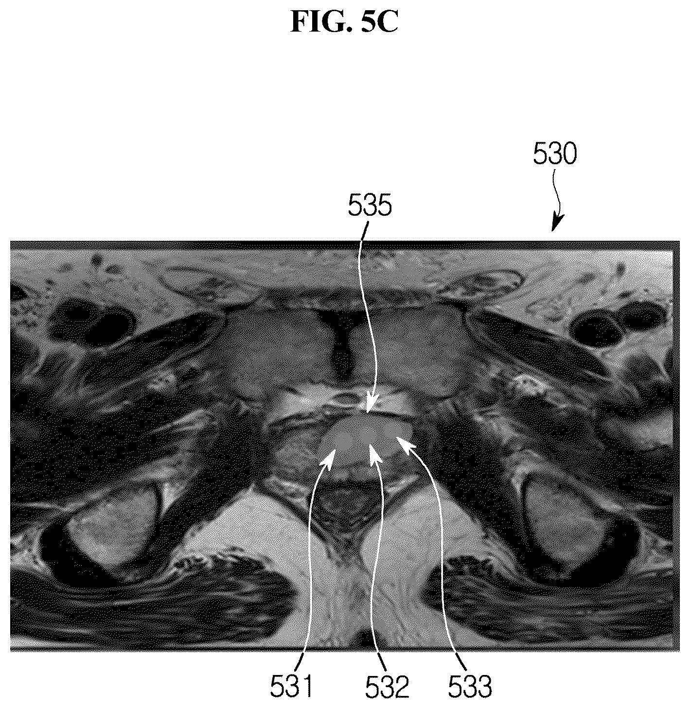 Patent US11854193 Figure 10 – Validity evaluation device for cancer region detection