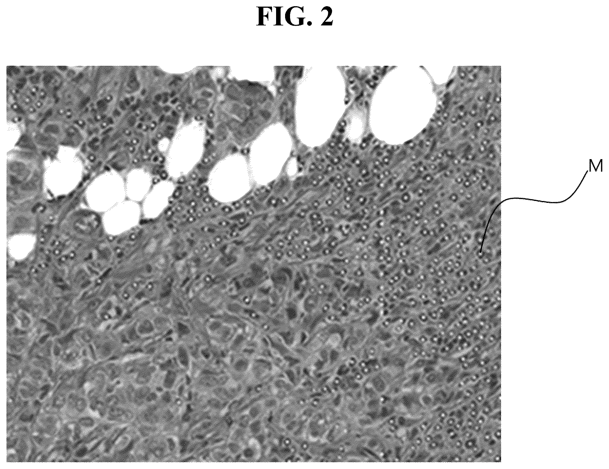 Patent US11854194 Figure 2 – Method and system for analyzing image