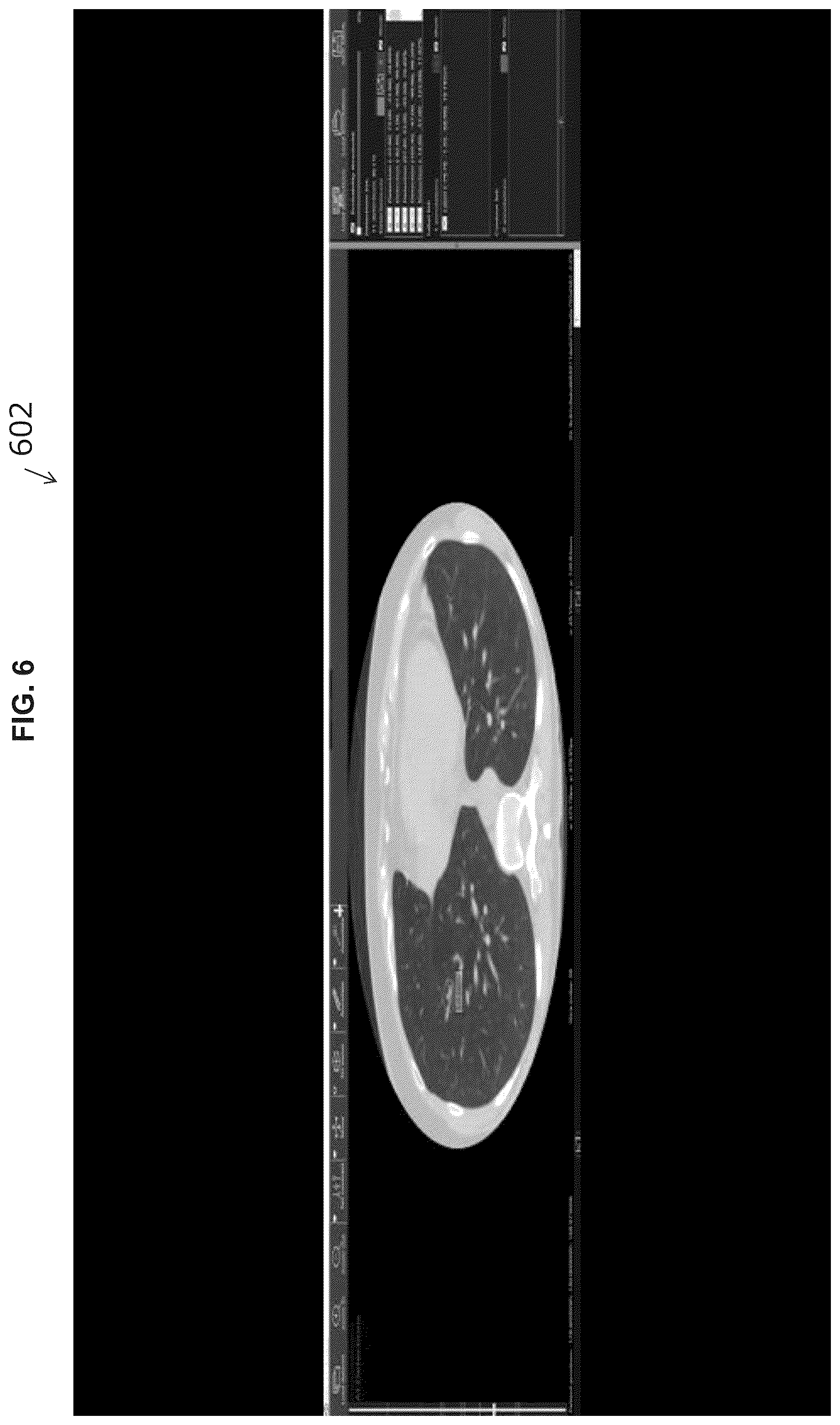 Patent US11854195 Figure 6 – Systems and methods for automated analysis of medical images