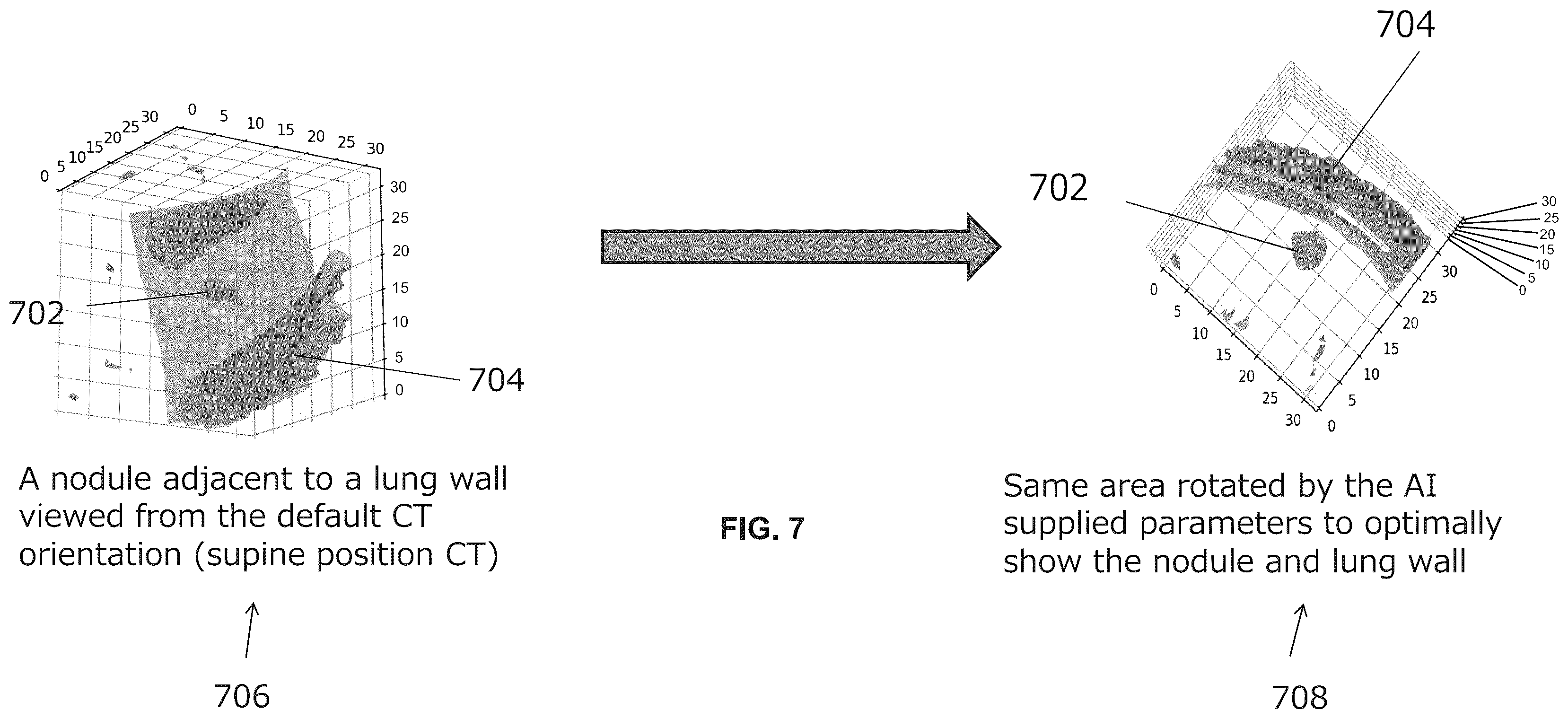 Patent US11854195 Figure 7 – Systems and methods for automated analysis of medical images