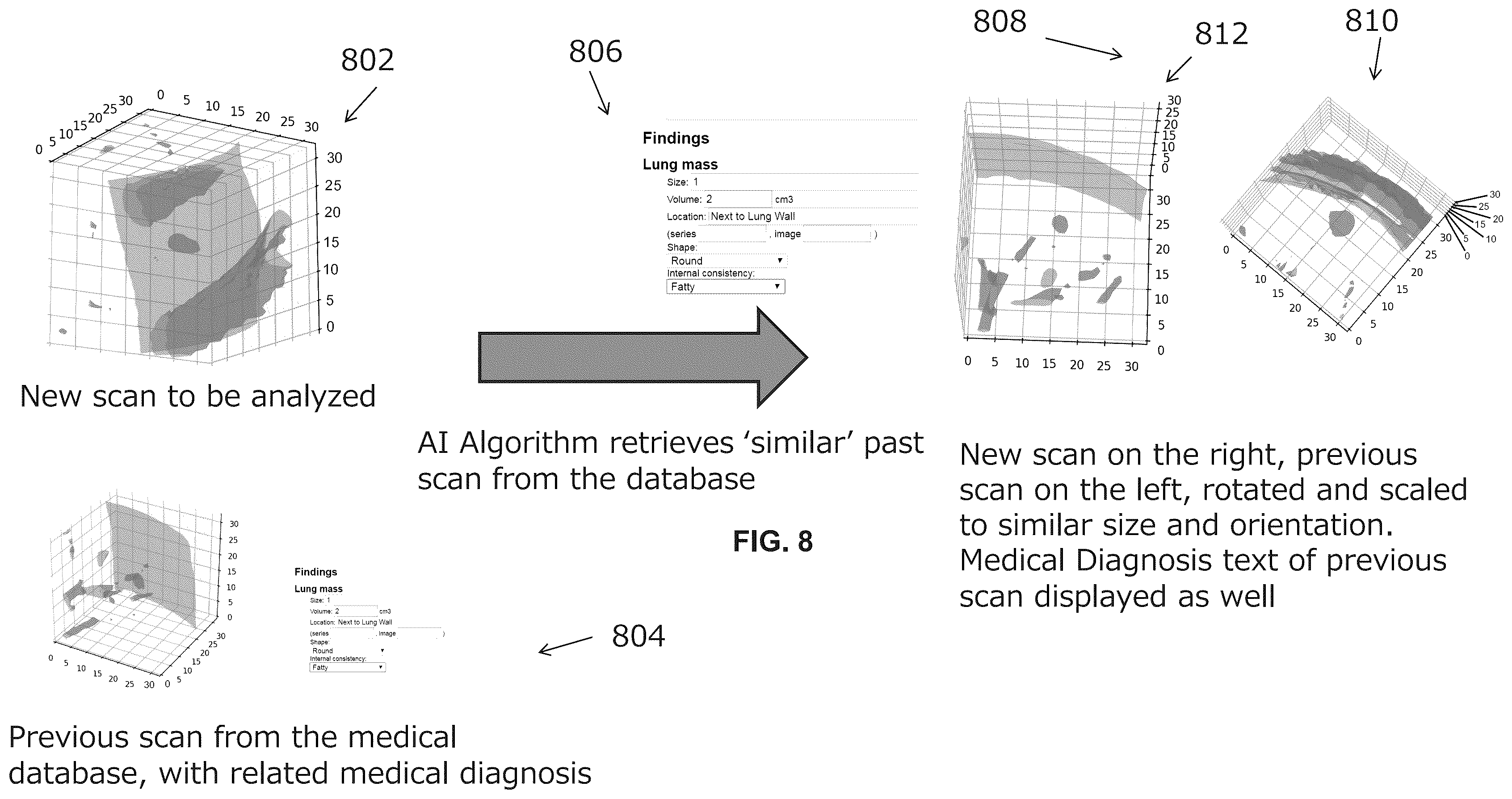 Patent US11854195 Figure 8 – Systems and methods for automated analysis of medical images