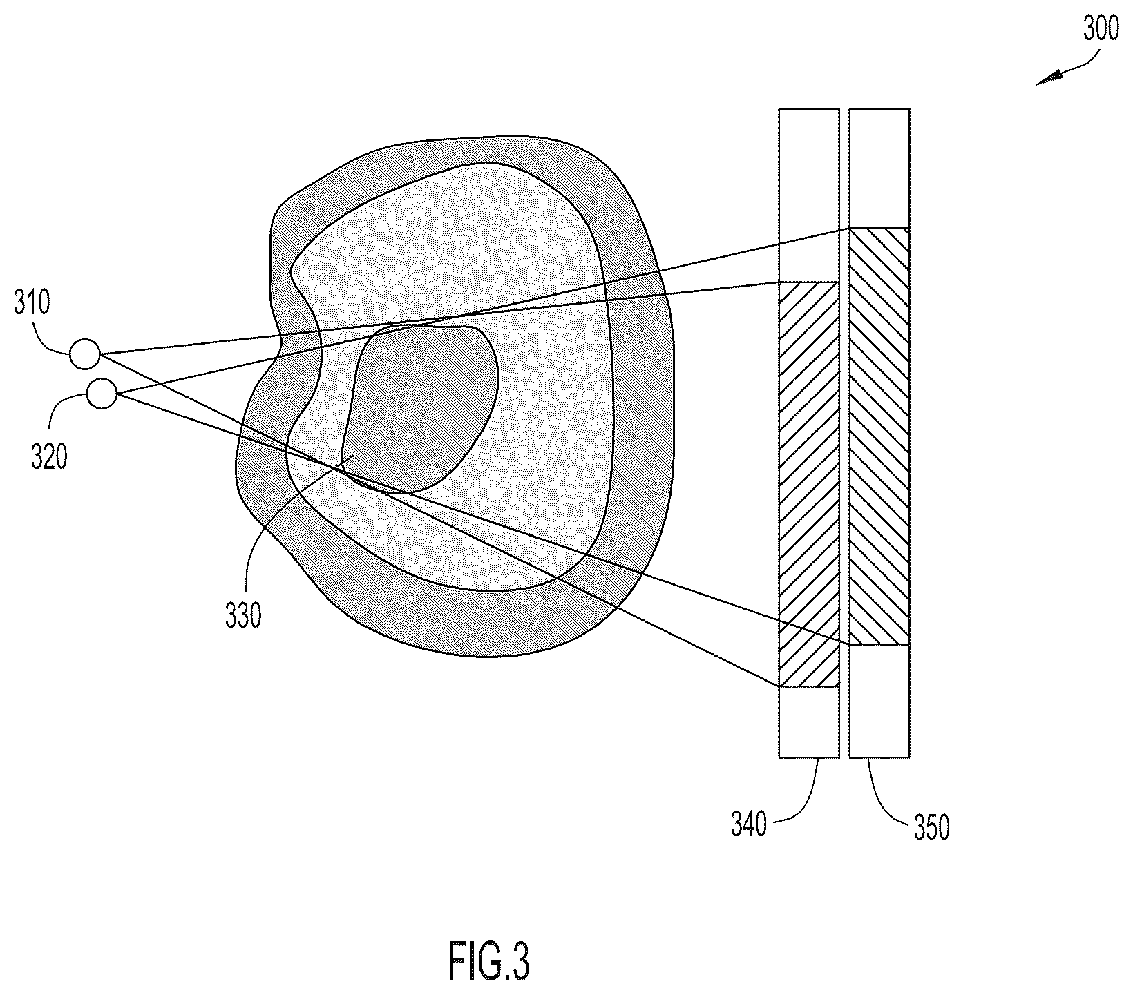 Patent US11854197 Figure 3 – Classification of medical images using machine learning to account for body orientation
