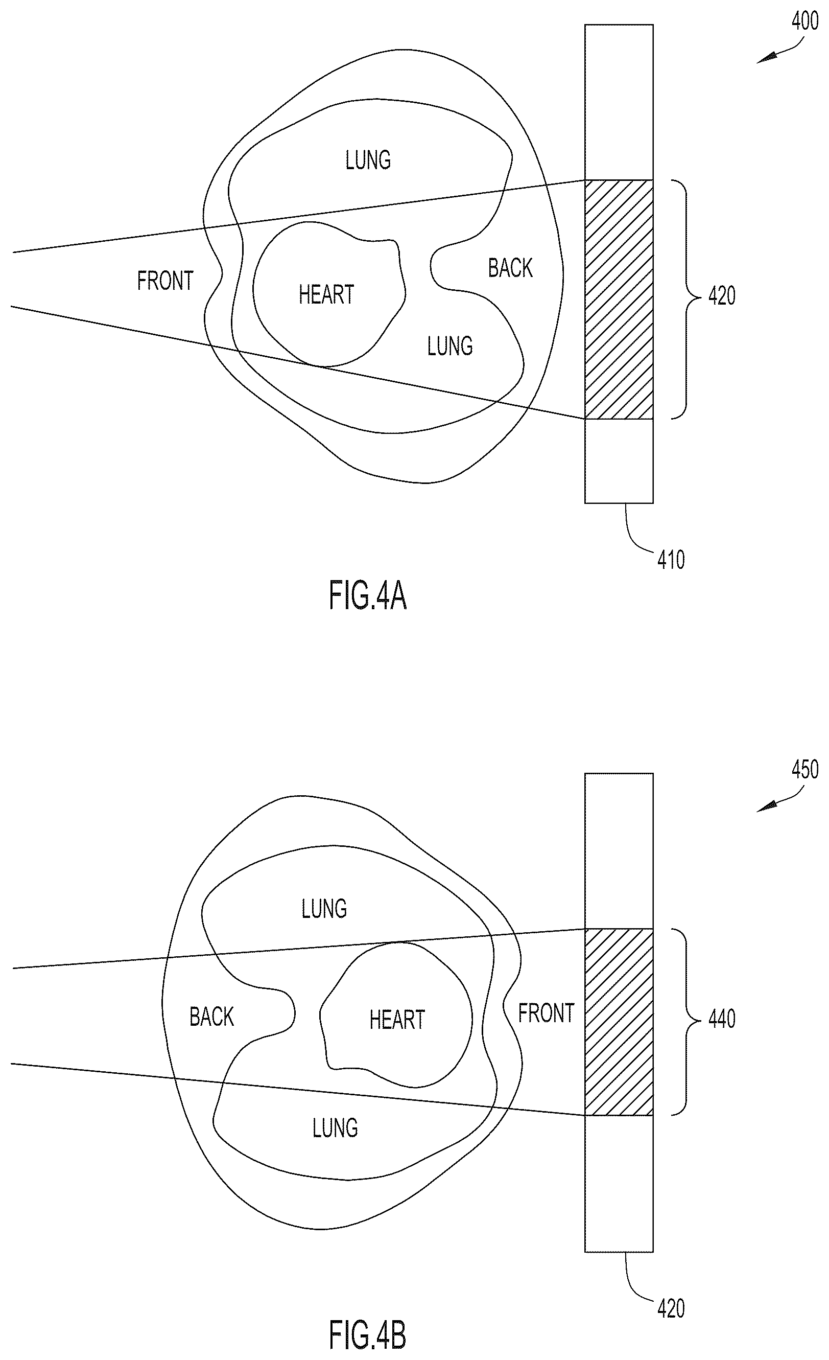 Patent US11854197 Figure 4 – Classification of medical images using machine learning to account for body orientation