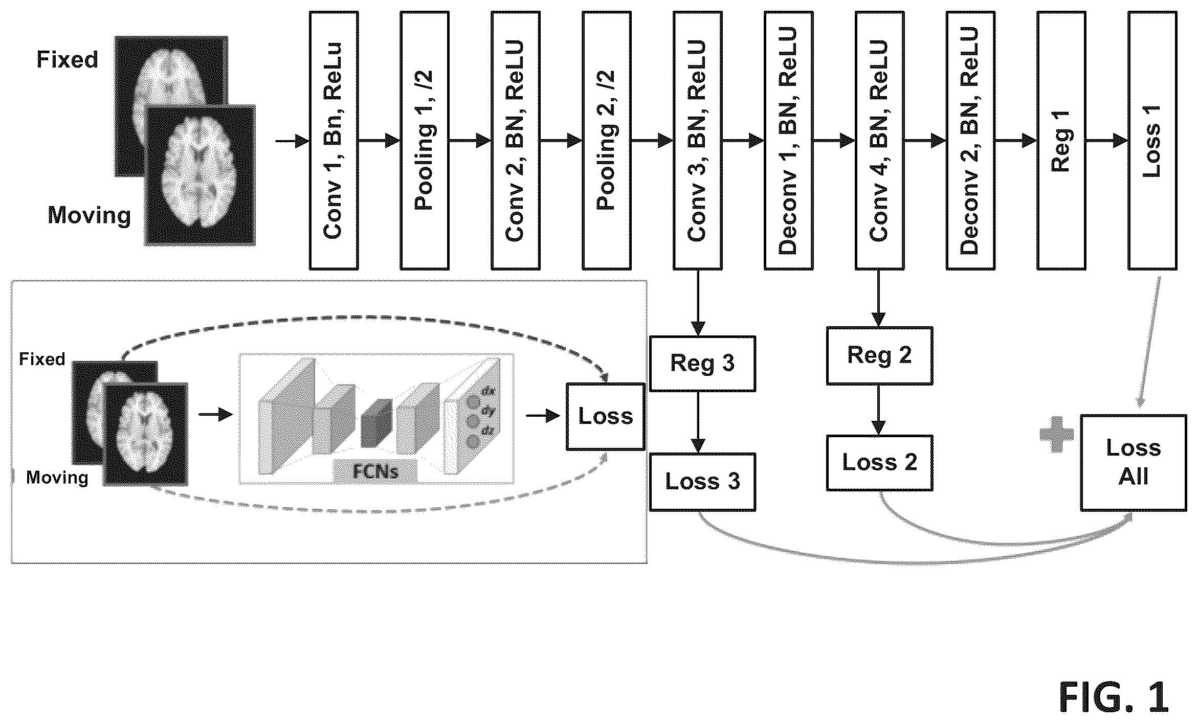 Patent US11854202 Figure 1 – Image registration using a fully convolutional network
