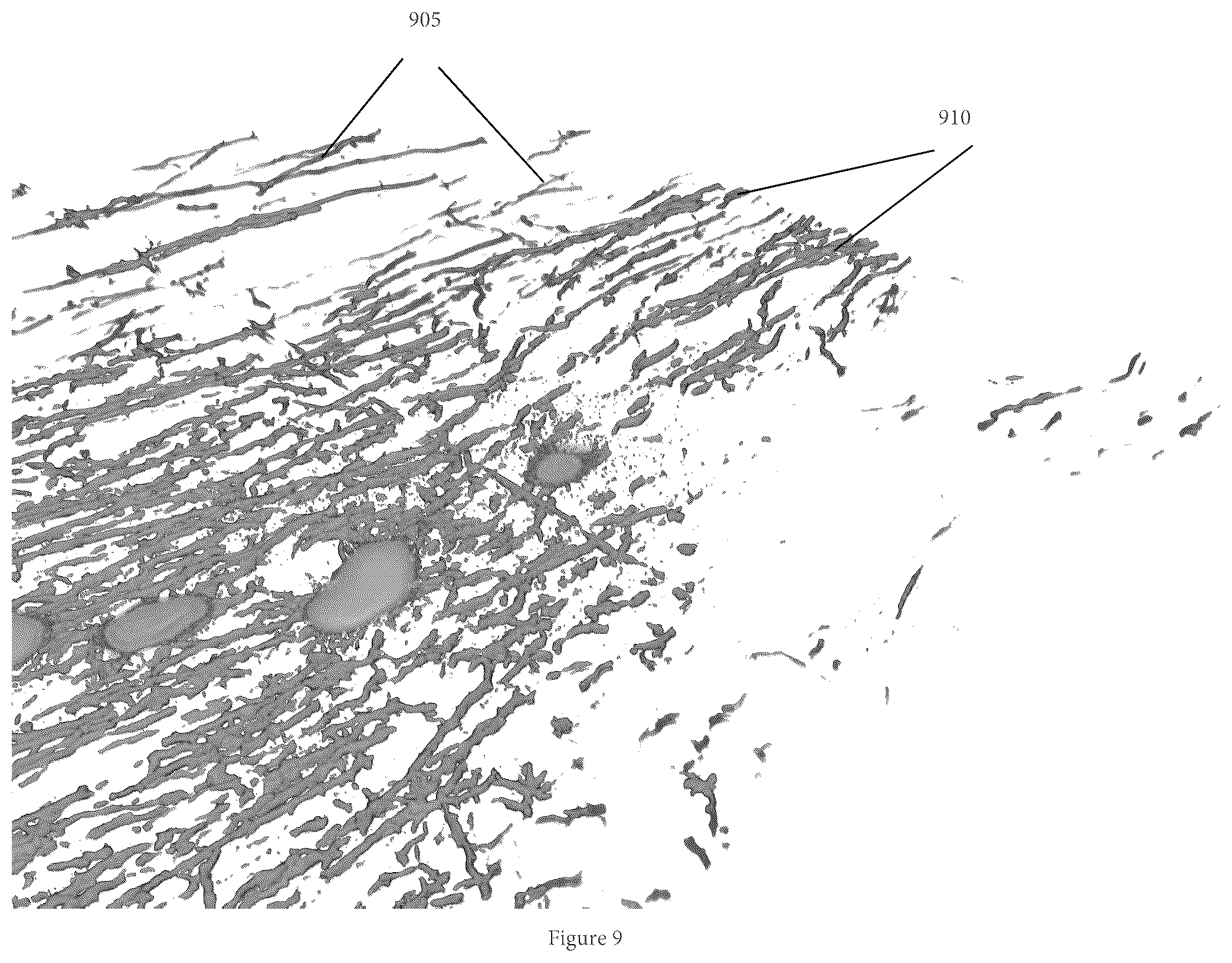Patent US11854281 Figure 11 – System, method, and computer-accessible medium for processing brain images and extracting neuronal structures