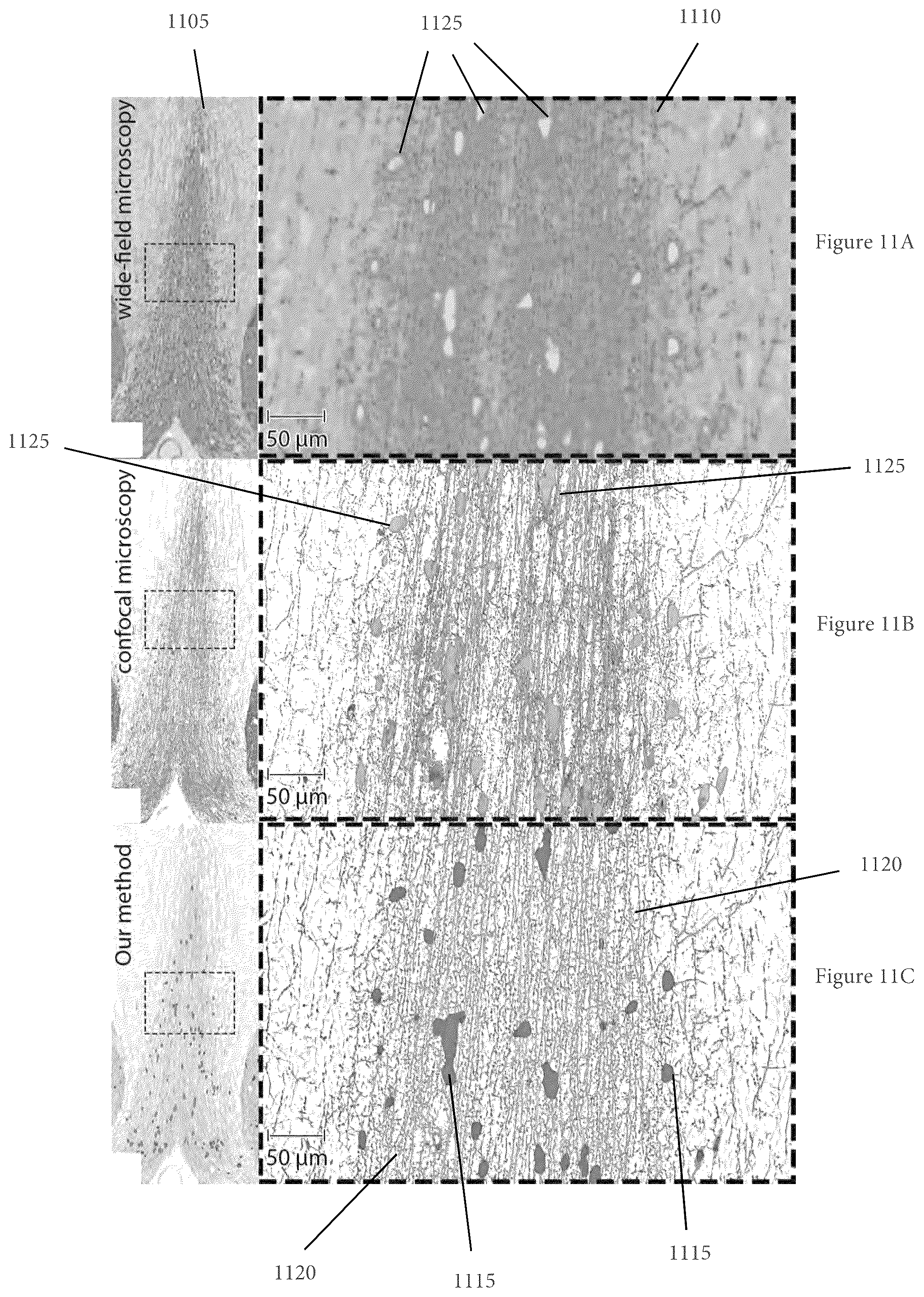 Patent US11854281 Figure 13 – System, method, and computer-accessible medium for processing brain images and extracting neuronal structures
