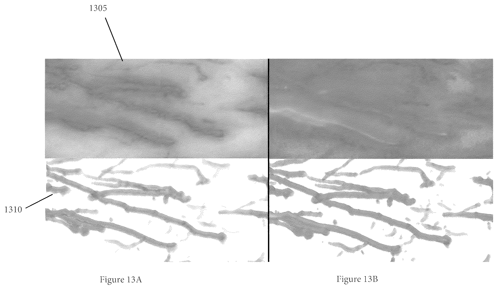 Patent US11854281 Figure 15 – System, method, and computer-accessible medium for processing brain images and extracting neuronal structures