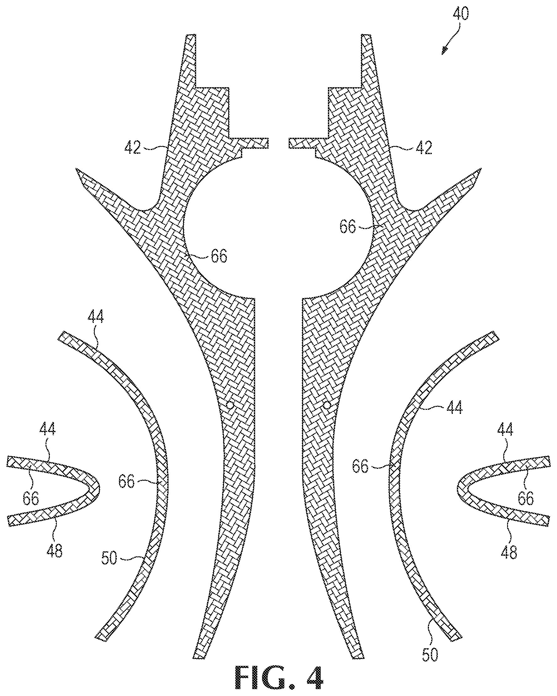 Patent US11854517 Figure 3 – Soundboards and backboards for acoustic stringed instruments