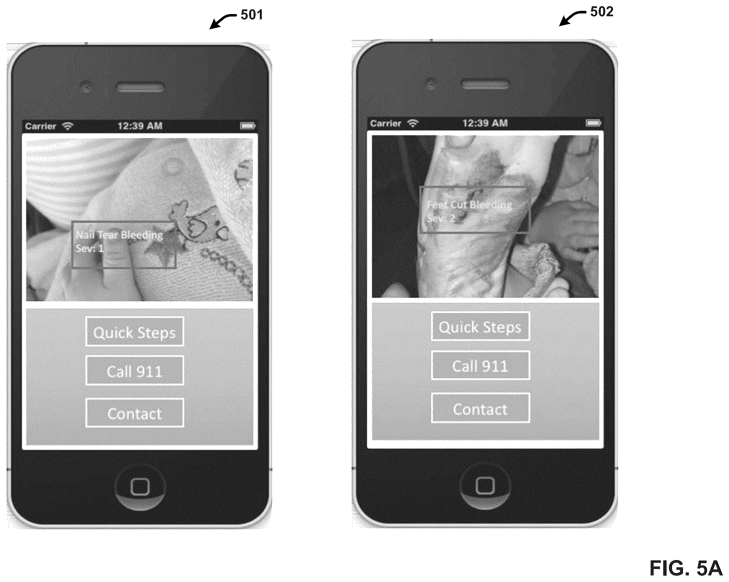 Patent US11854676 Figure 5 – Providing live first aid response guidance using a machine learning based cognitive aid planner