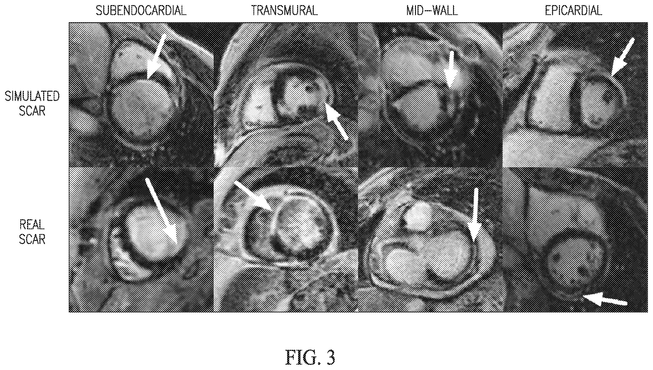 Patent US11854703 Figure 3 – Simulating abnormalities in medical images with generative adversarial networks
