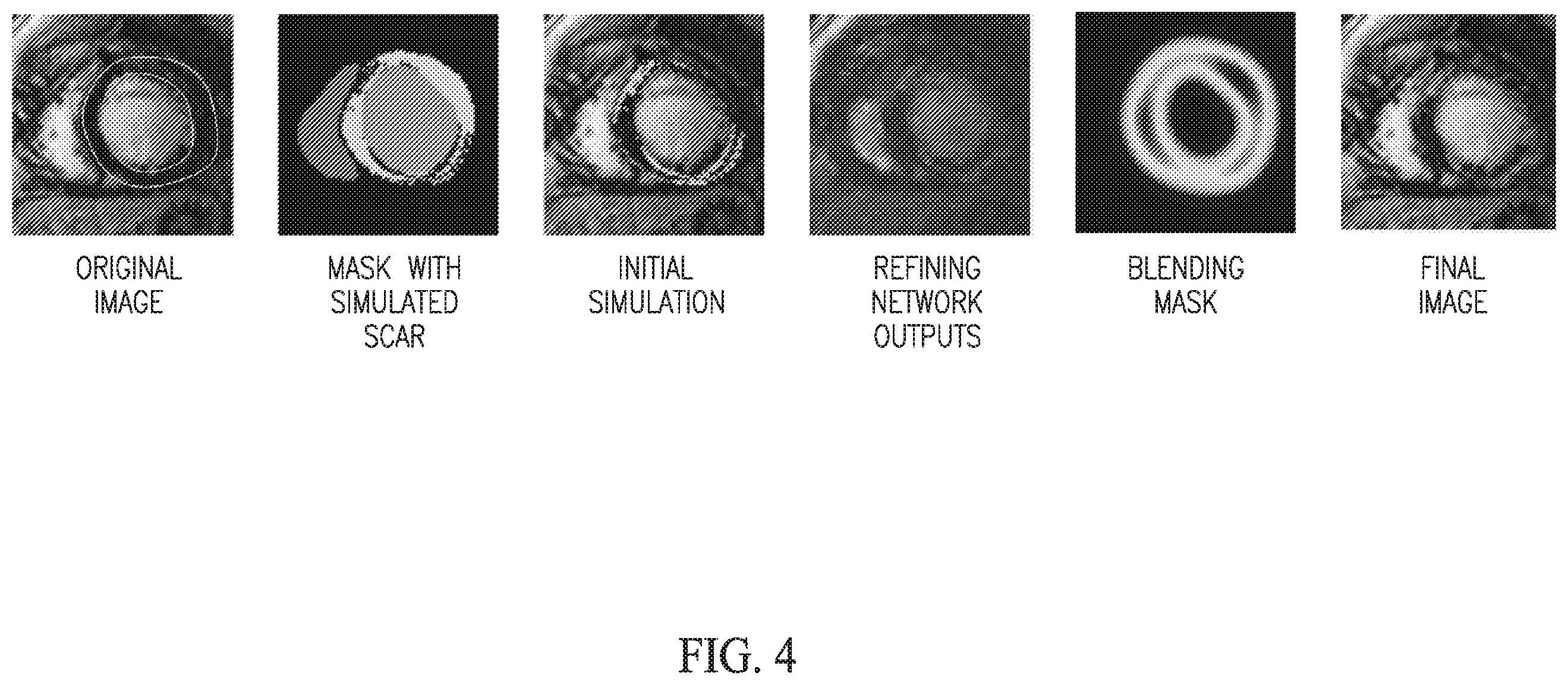 Patent US11854703 Figure 4 – Simulating abnormalities in medical images with generative adversarial networks