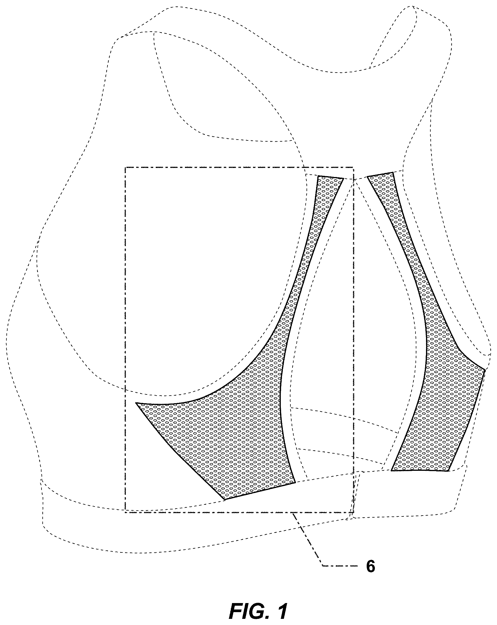 Patent USD0999477 Figure 1 – Bra