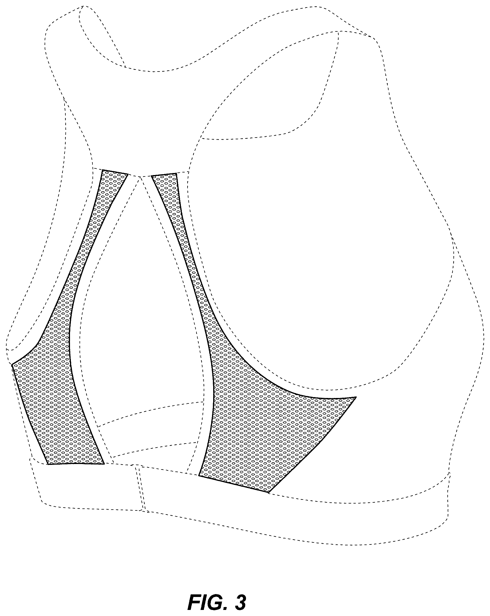 Patent USD0999477 Figure 3 – Bra