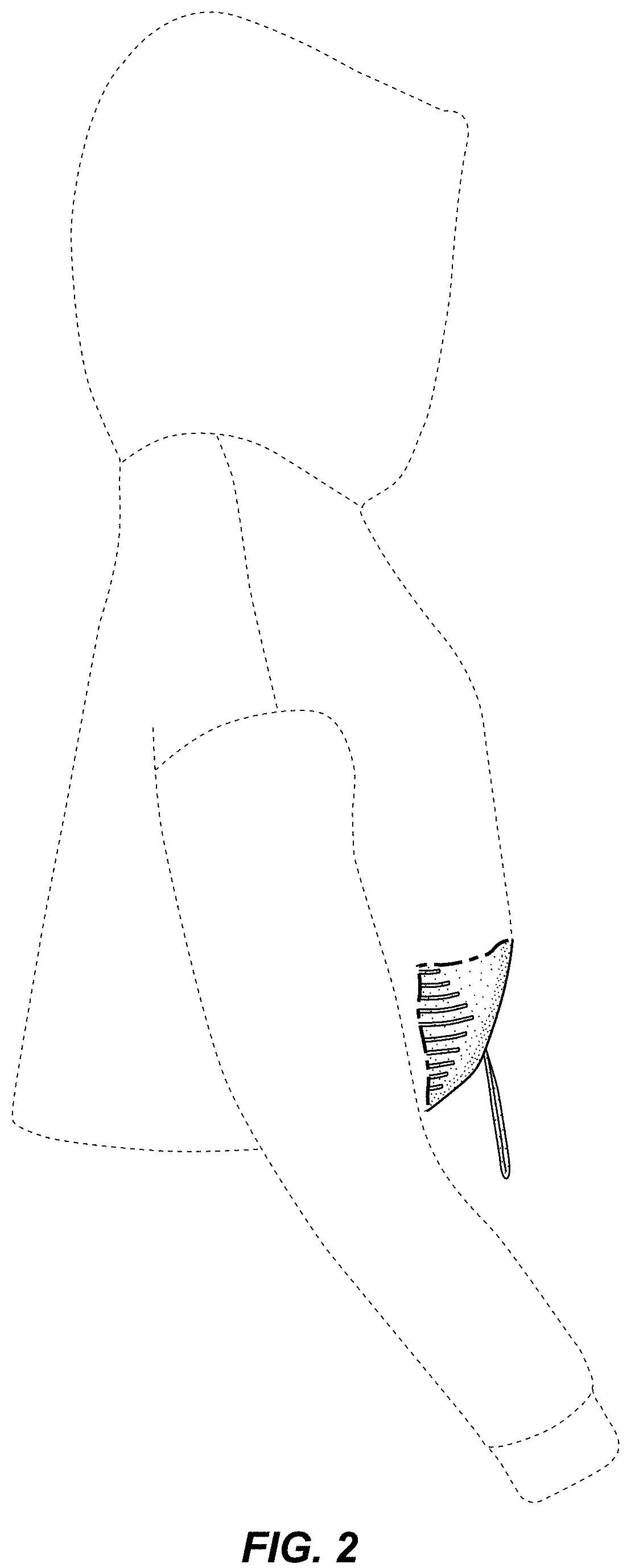 Patent USD0999484 Figure 2 – Hoodie