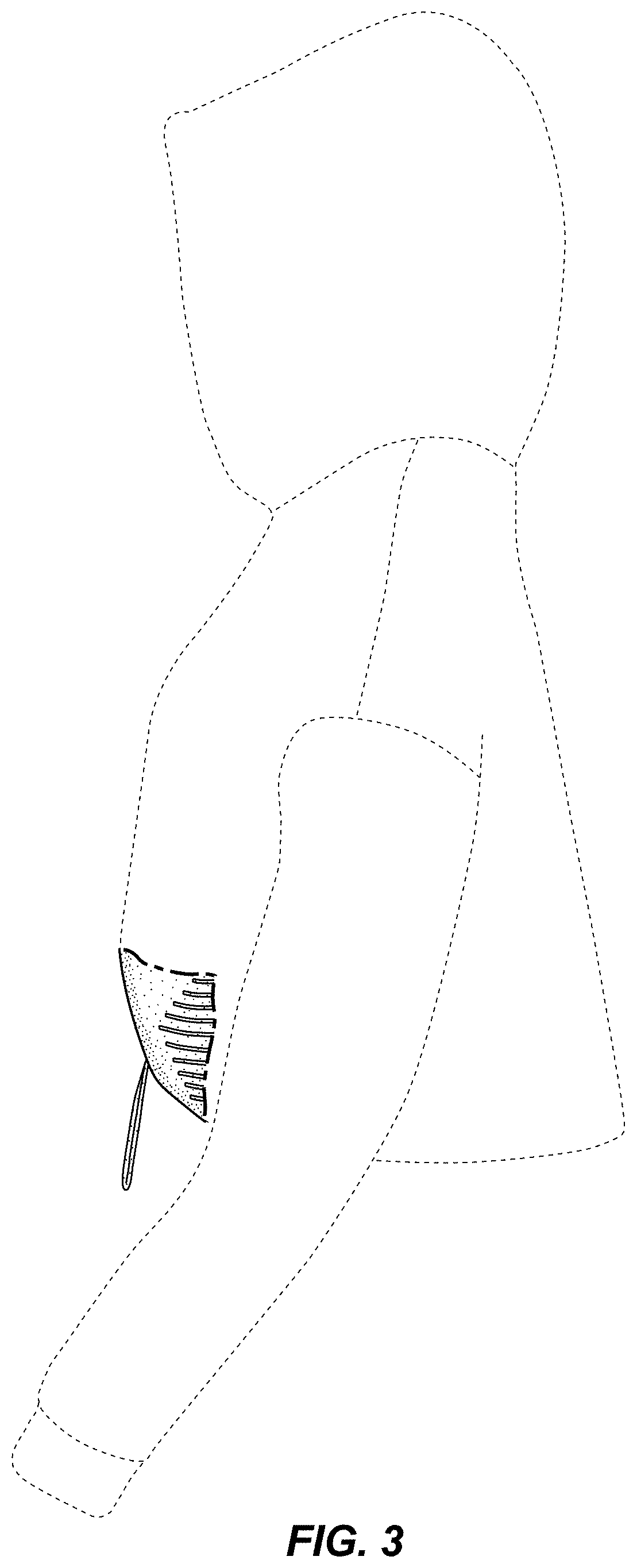 Patent USD0999484 Figure 3 – Hoodie