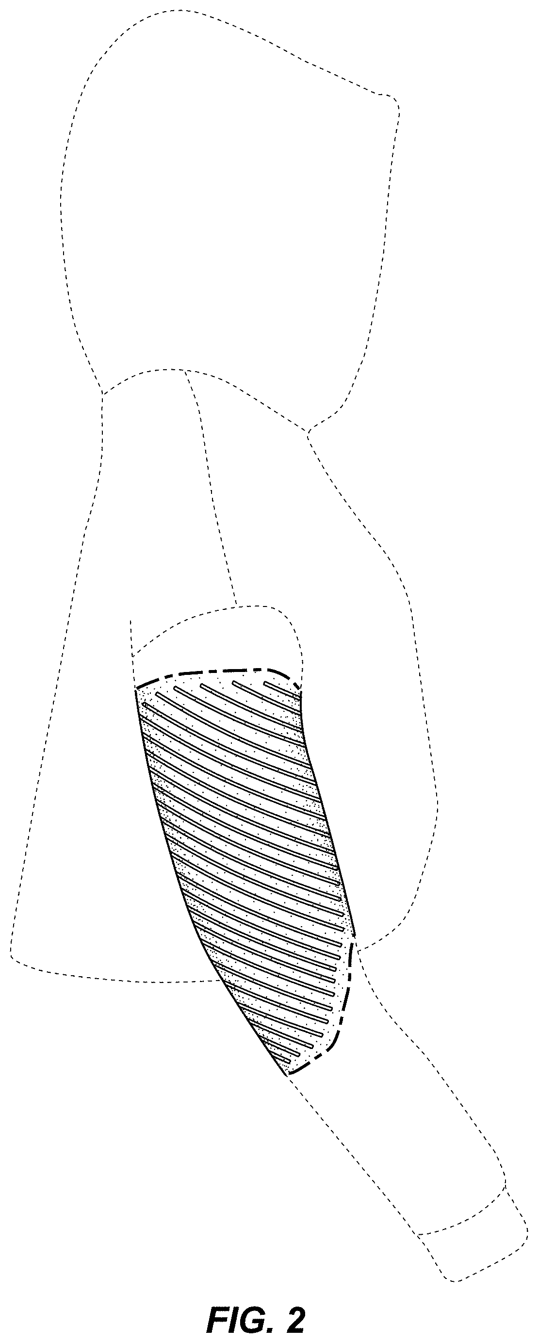 Patent USD0999485 Figure 2 – Hoodie