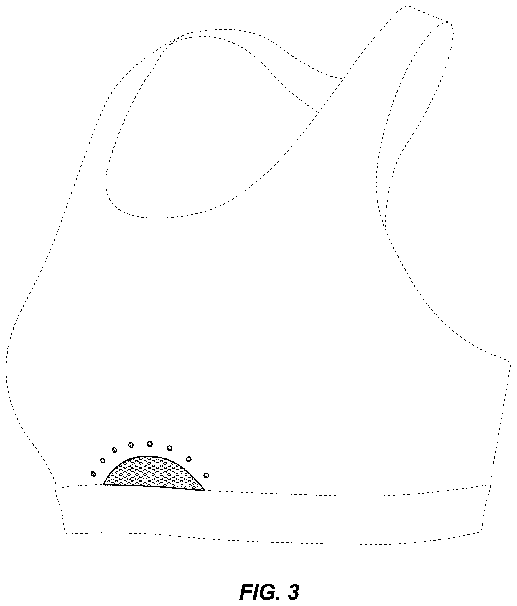Patent USD0999489 Figure 3 – Bra