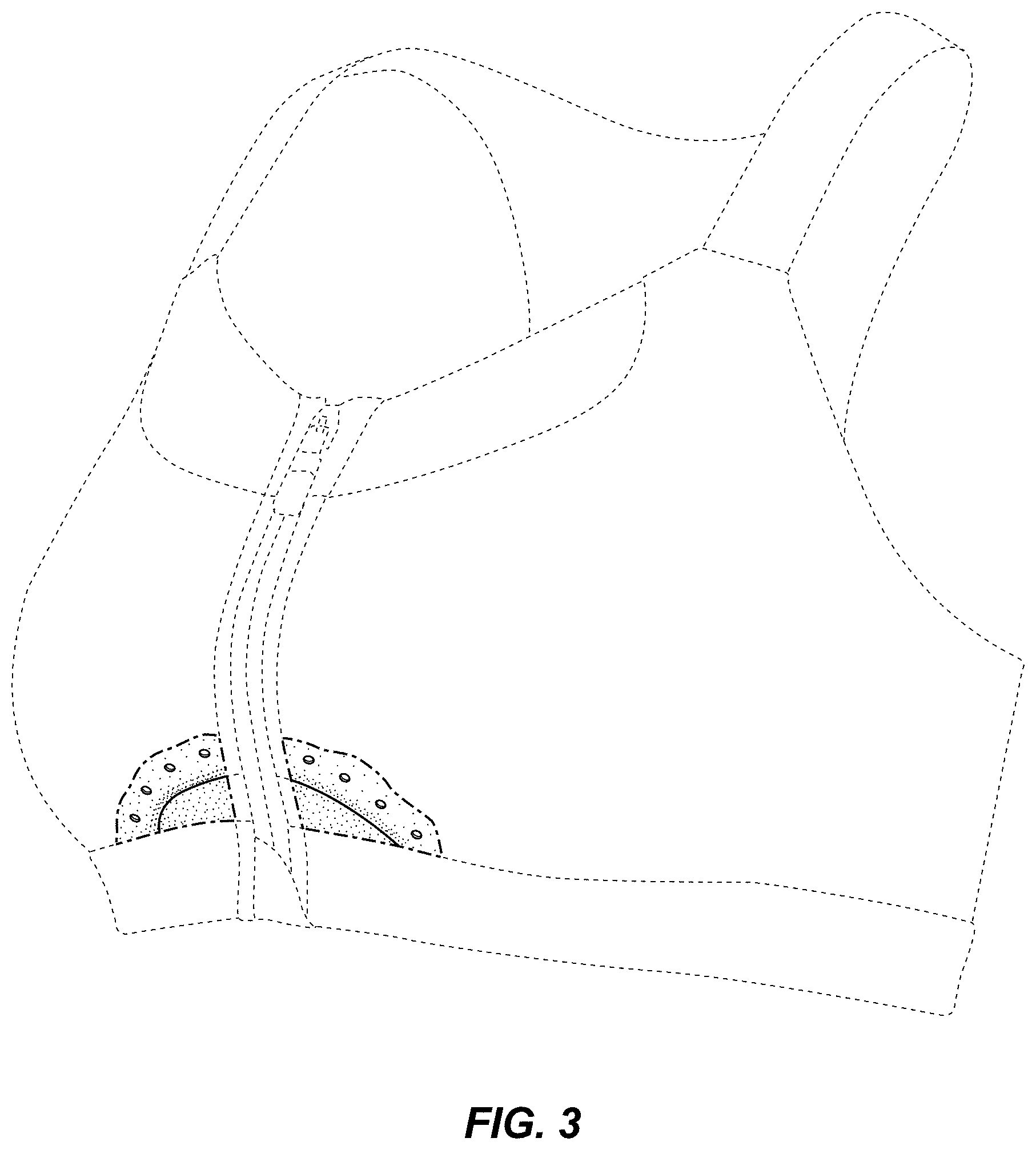 Patent USD0999490 Figure 3 – Bra