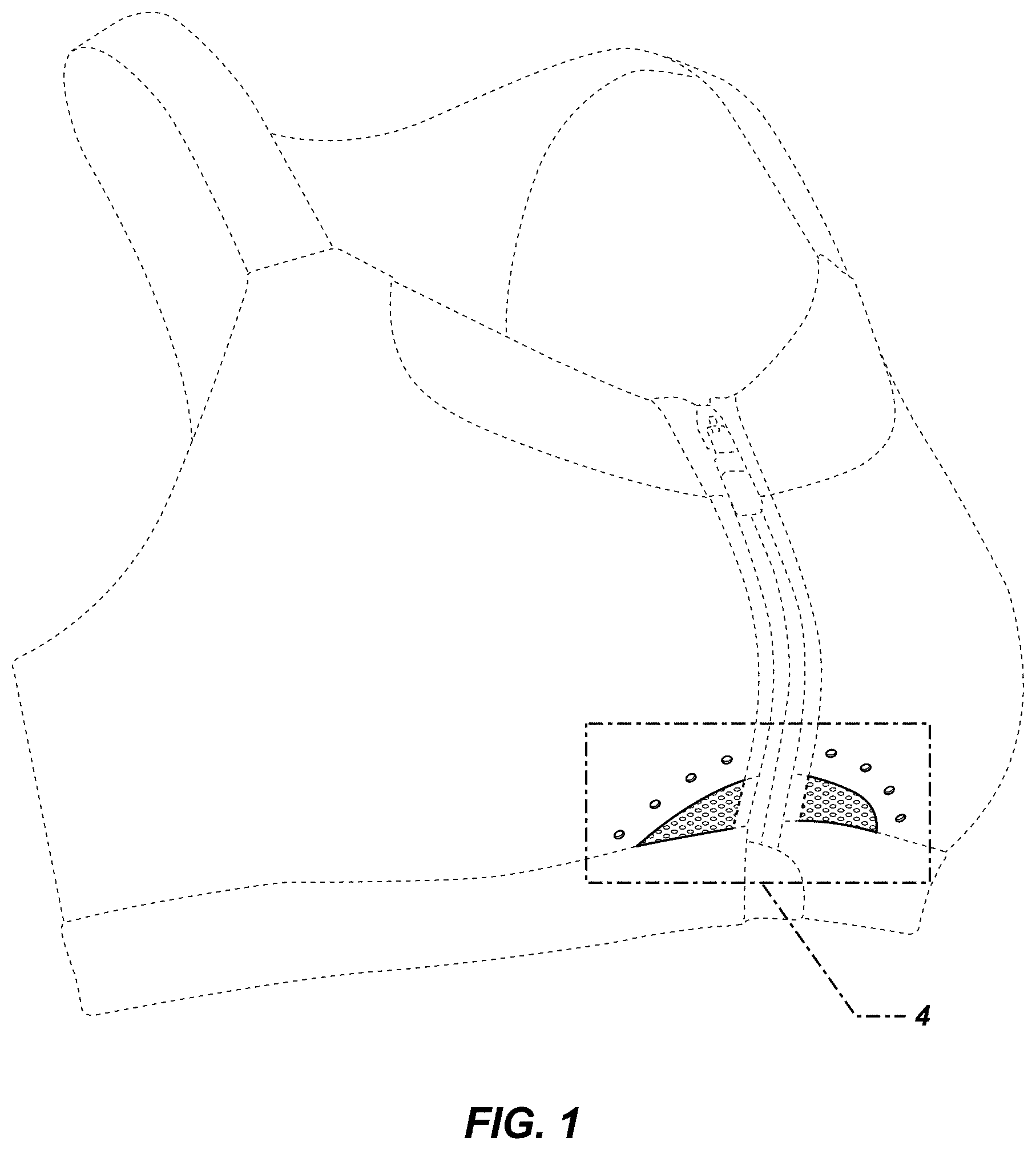 Patent USD0999491 Figure 1 – Bra