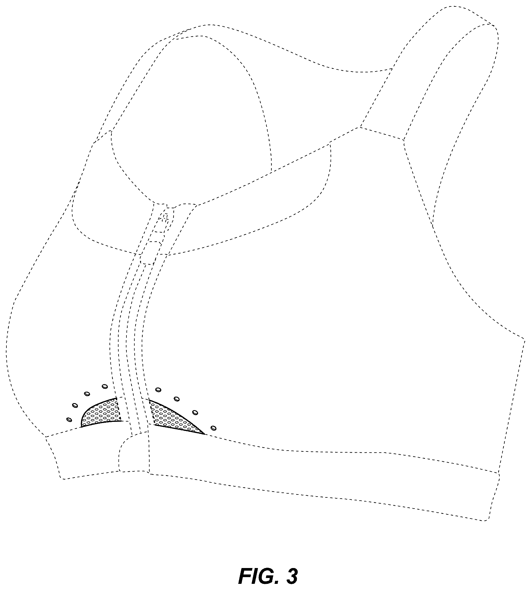 Patent USD0999491 Figure 3 – Bra